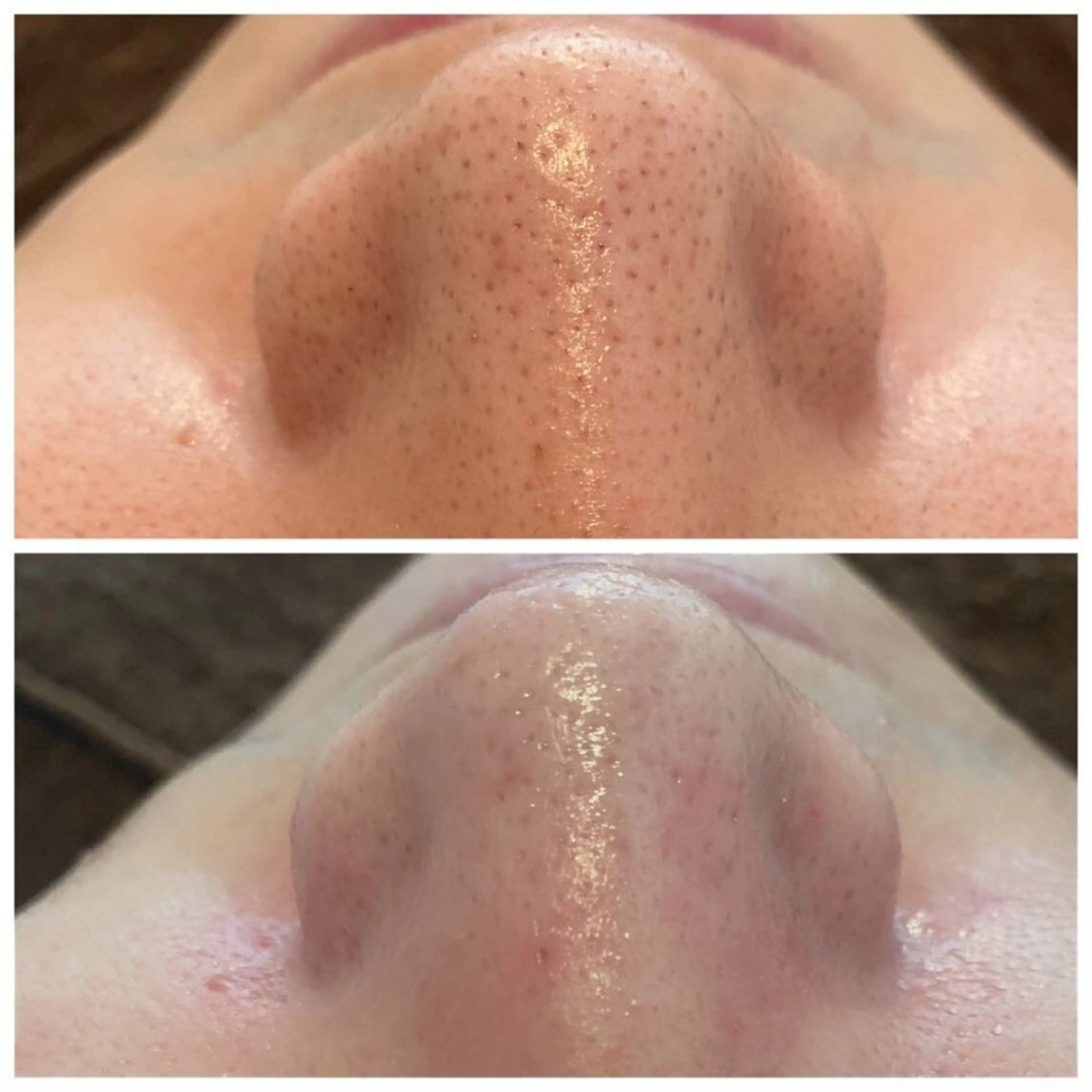 韓国肌管理★ 聖のエステ・リラクイメージ