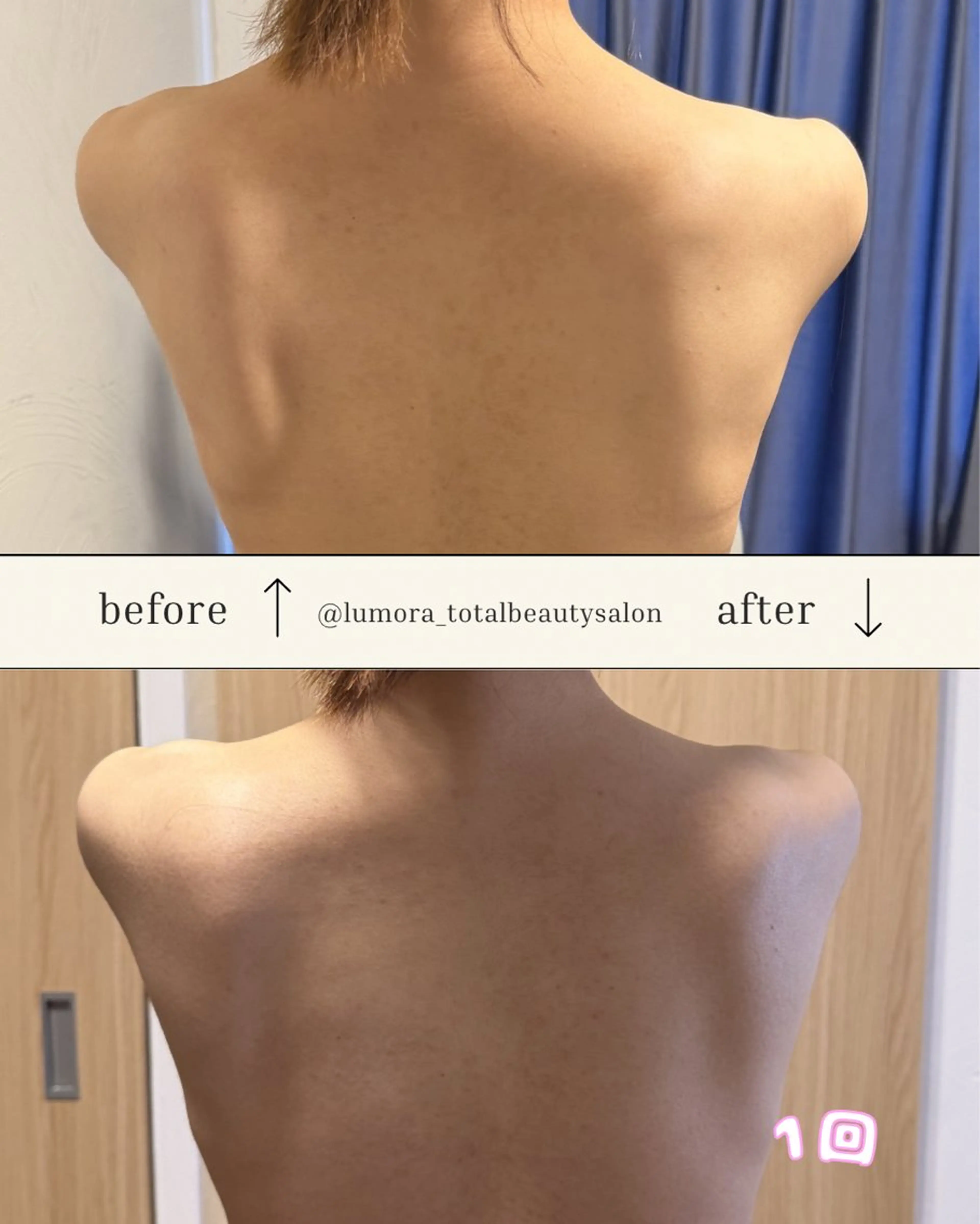 LUMORA🌟 トータルビューティーのエステ・リラクイメージ