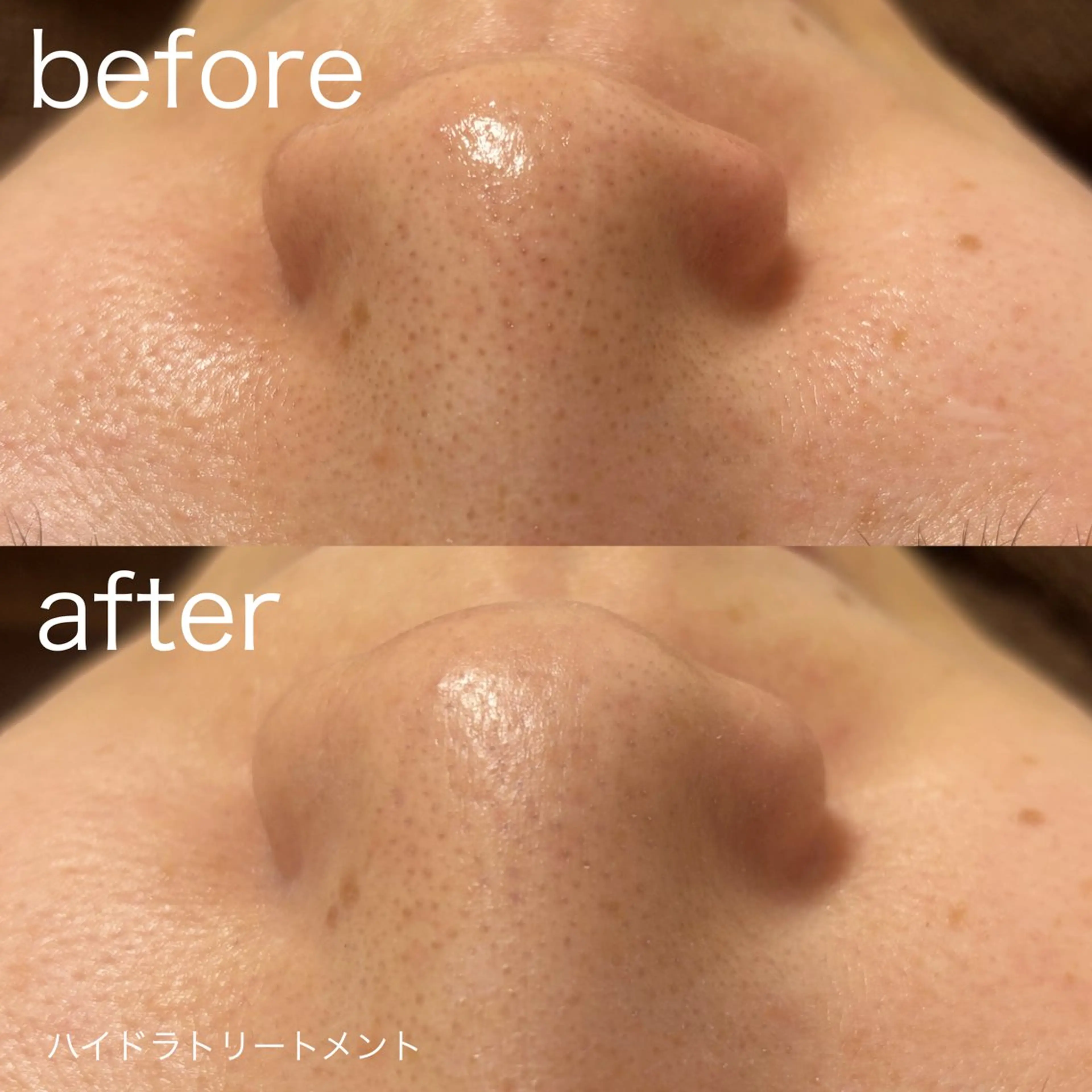 lulularico Yuのエステ・リラクイメージ
