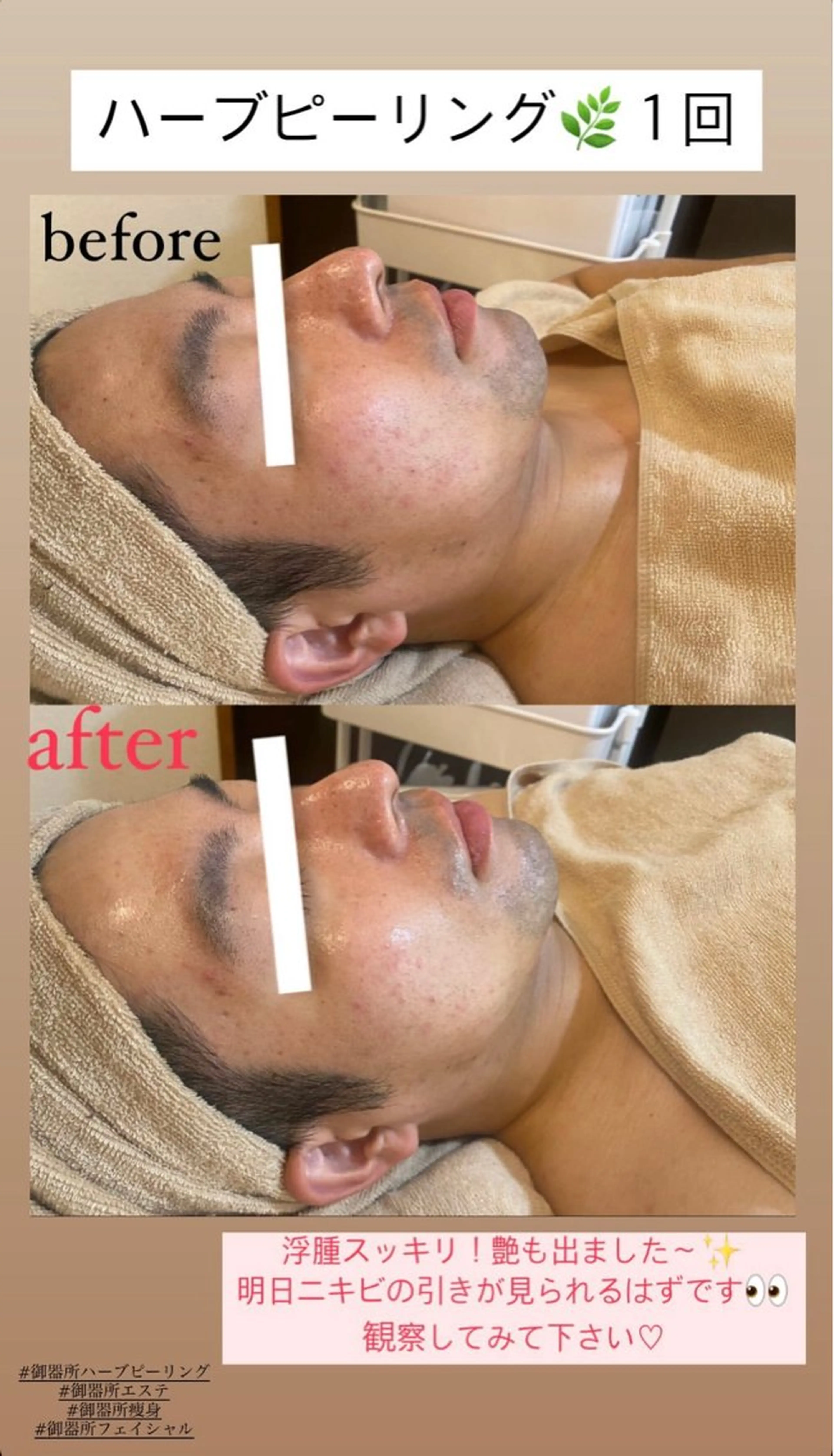 エステ Salon de Lino 御器所のエステ・リラクイメージ