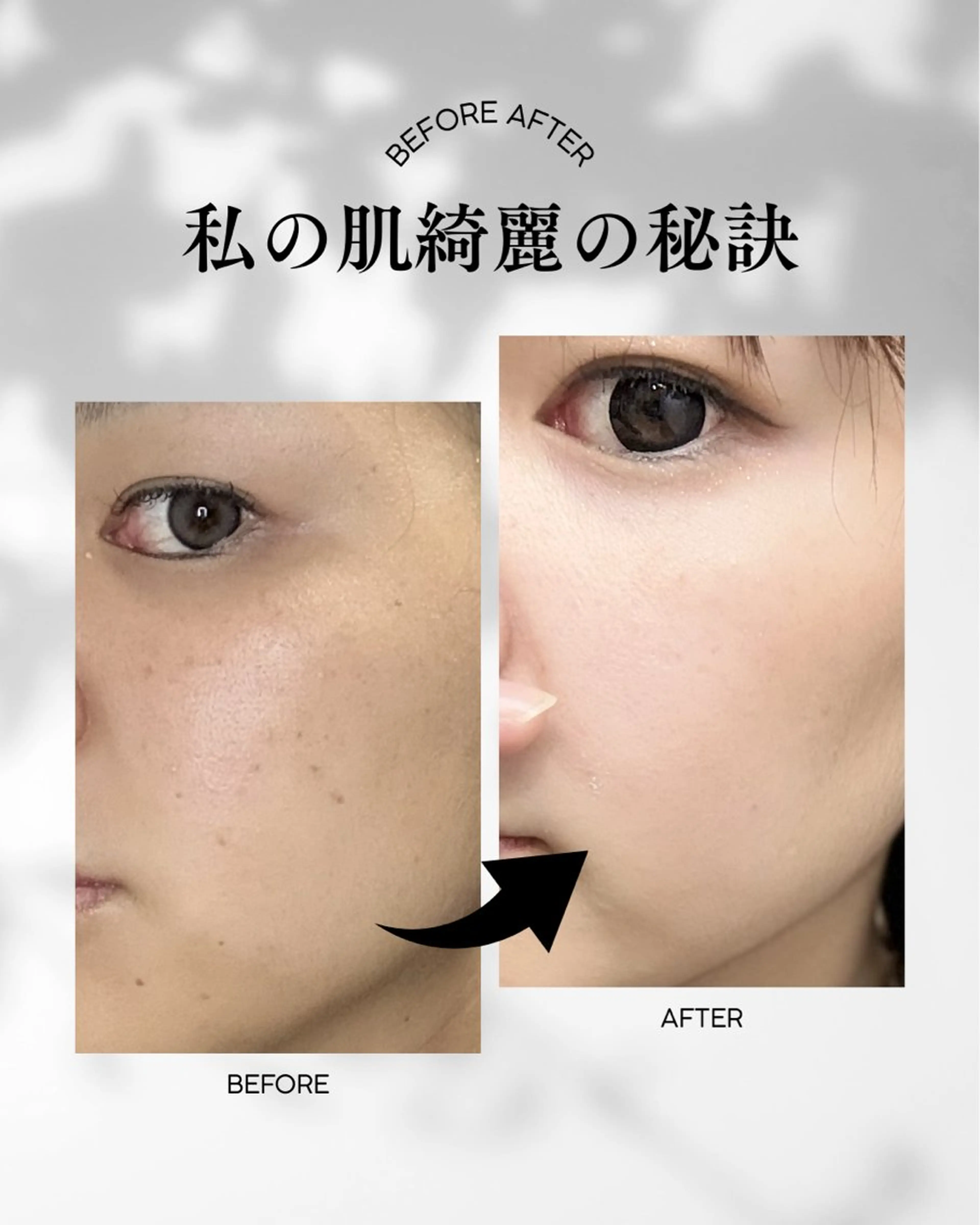 美白、シミ、くすみ、フェイシャルリンパ付きの写真