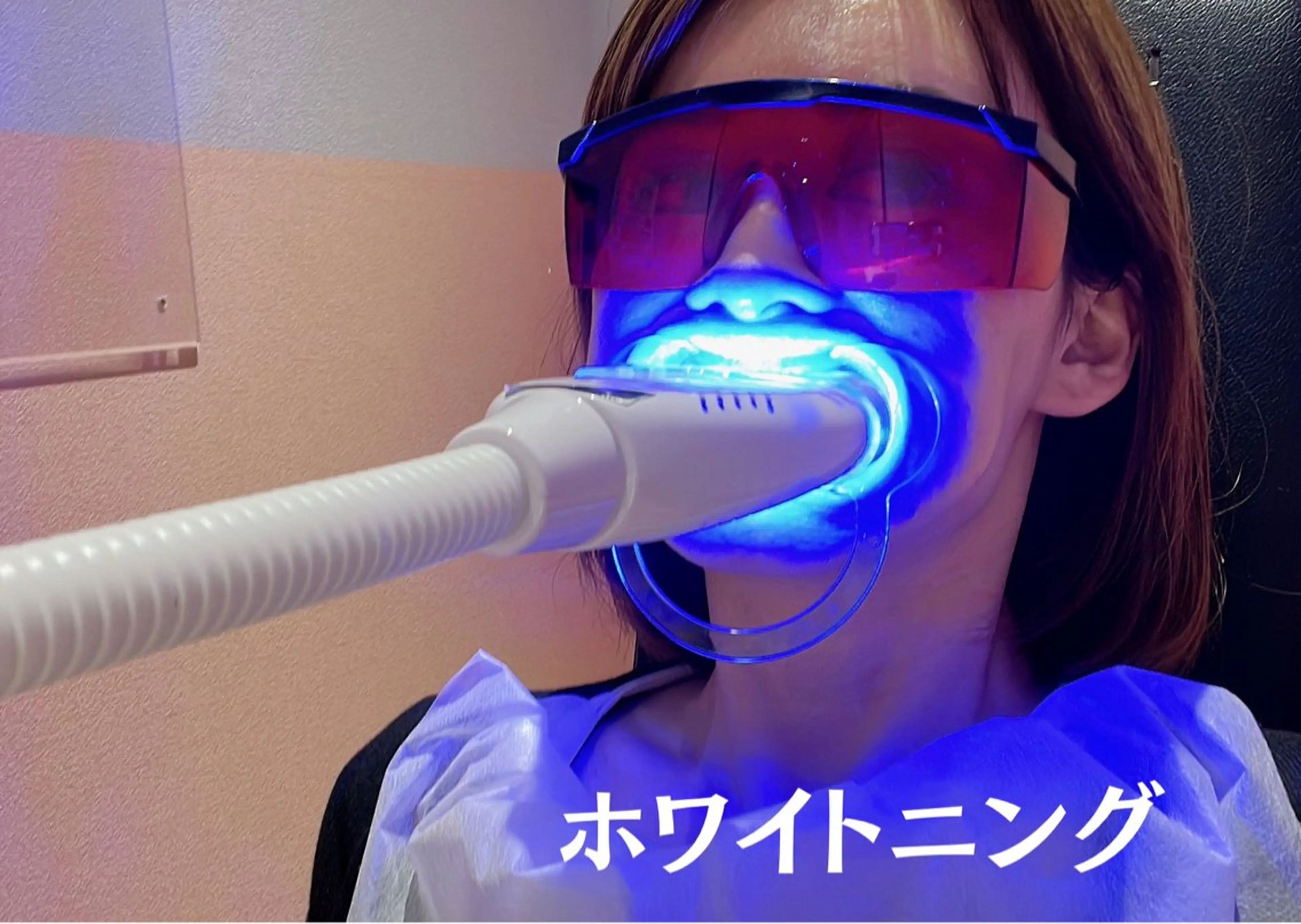 ✨初回お試し✨セルフホワイトニング(10分×4回照射)¥5500の写真