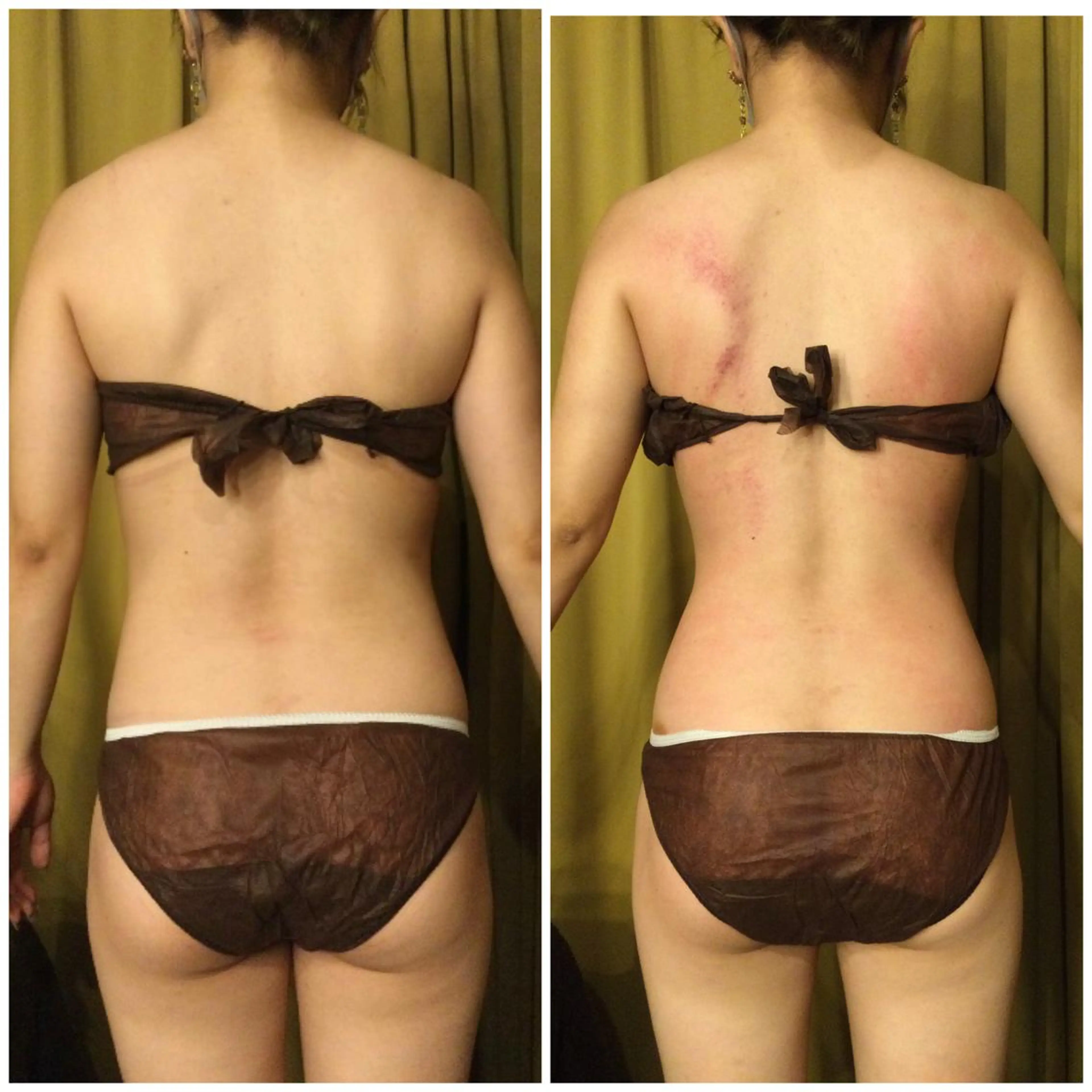 その他 小顔やたるみに特化 💚野瀬可蓮のその他イメージ