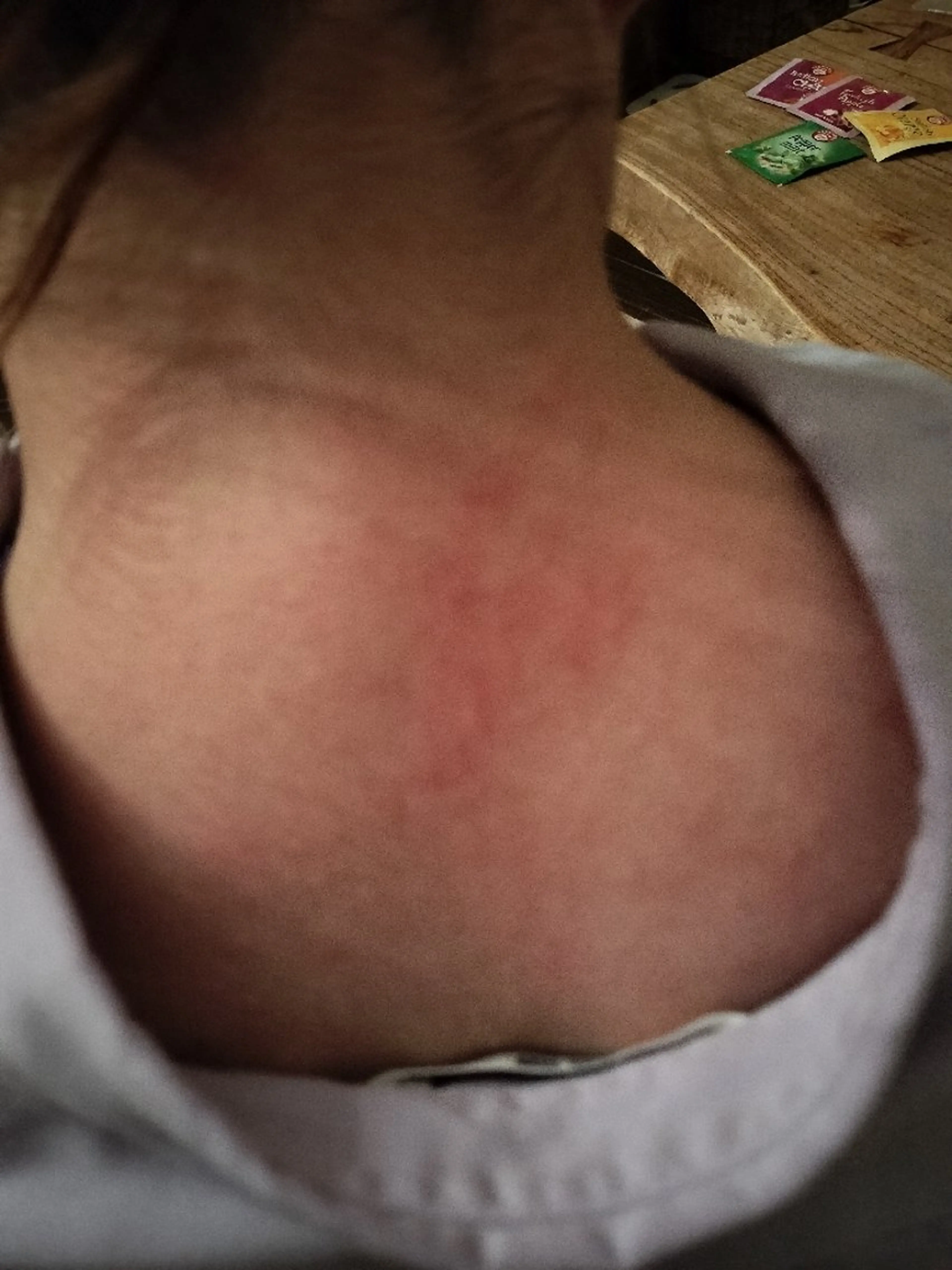 エステ リラク ☺ハーブピール💕 ソフィアカロン💖のエステ・リラクイメージ