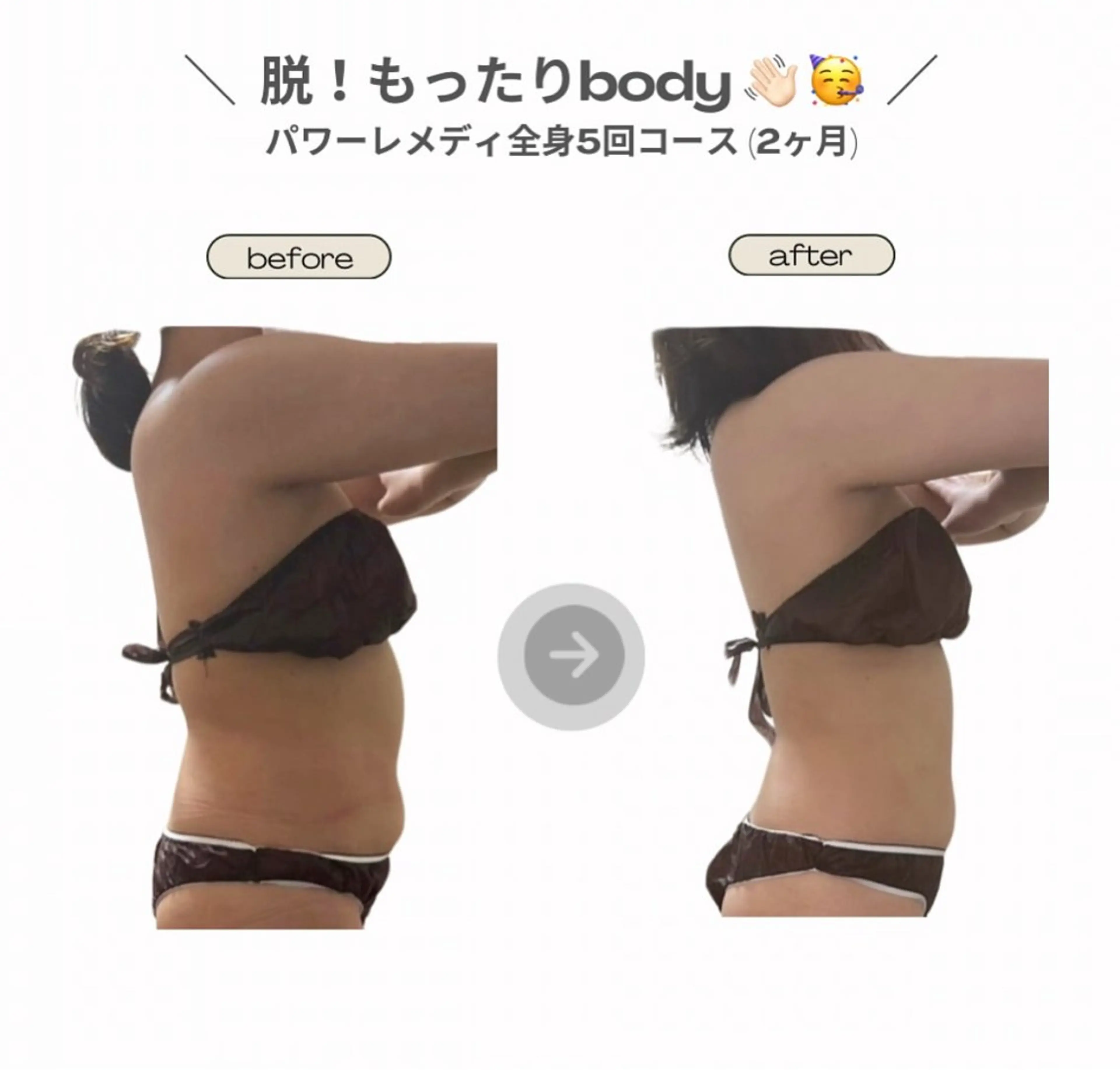 エステ リラク 《本気痩せ×疲労改善 》  BILOOPのエステ・リラクイメージ