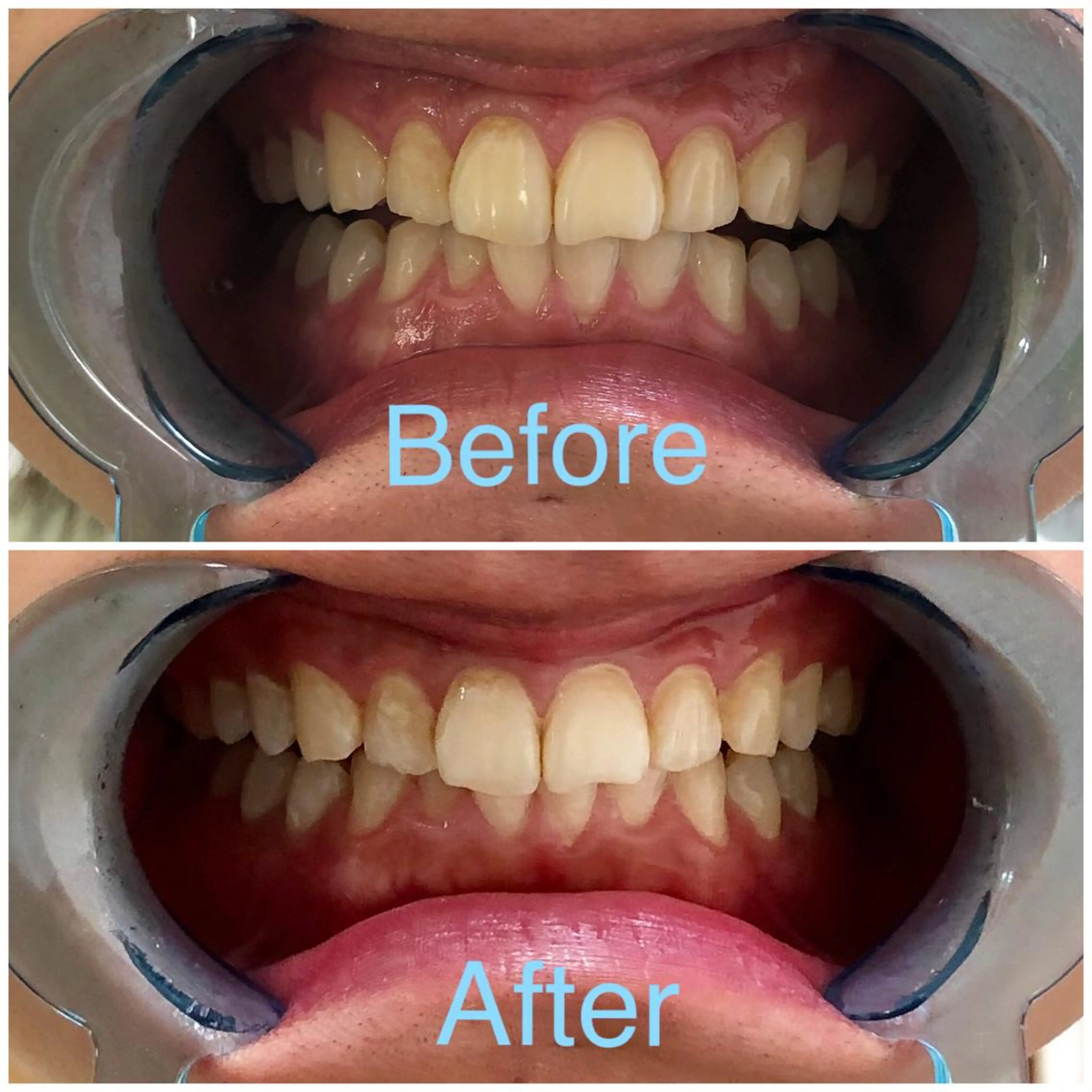 イーチブライト EachBrightのその他イメージ