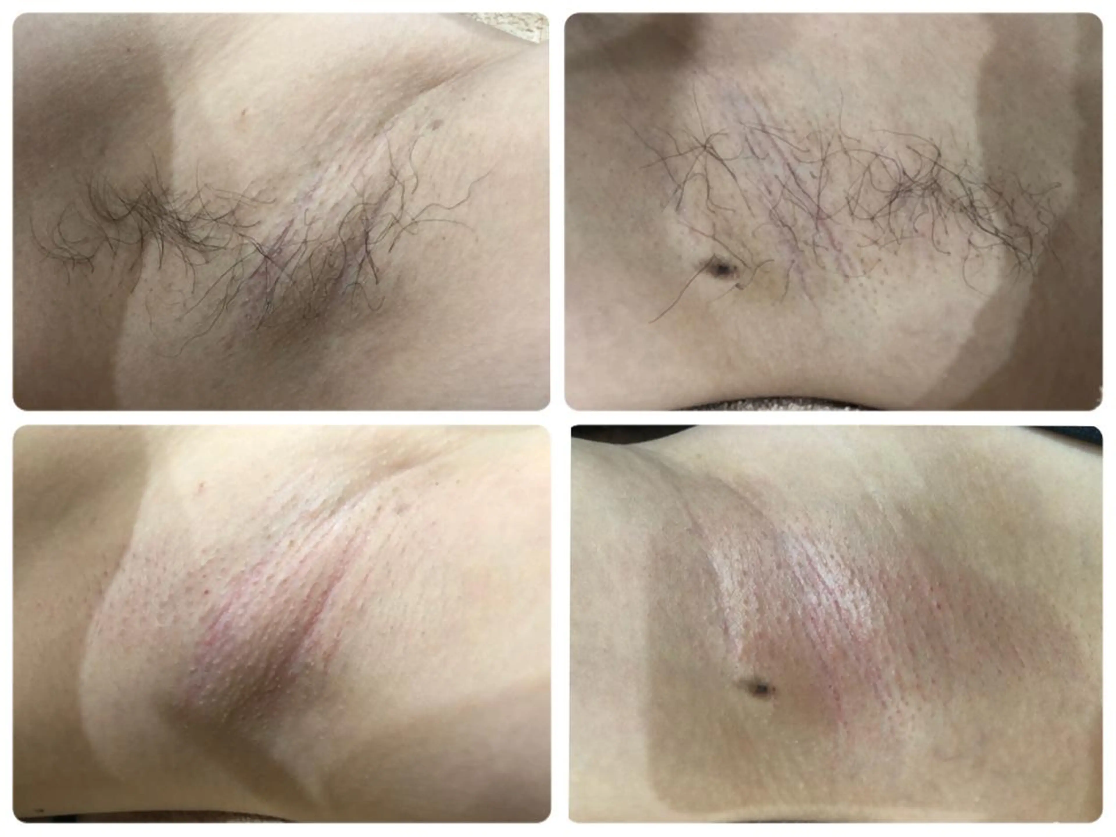 産後/ツヤ肌/子連れ /保育士在籍サロンのエステ・リラクイメージ