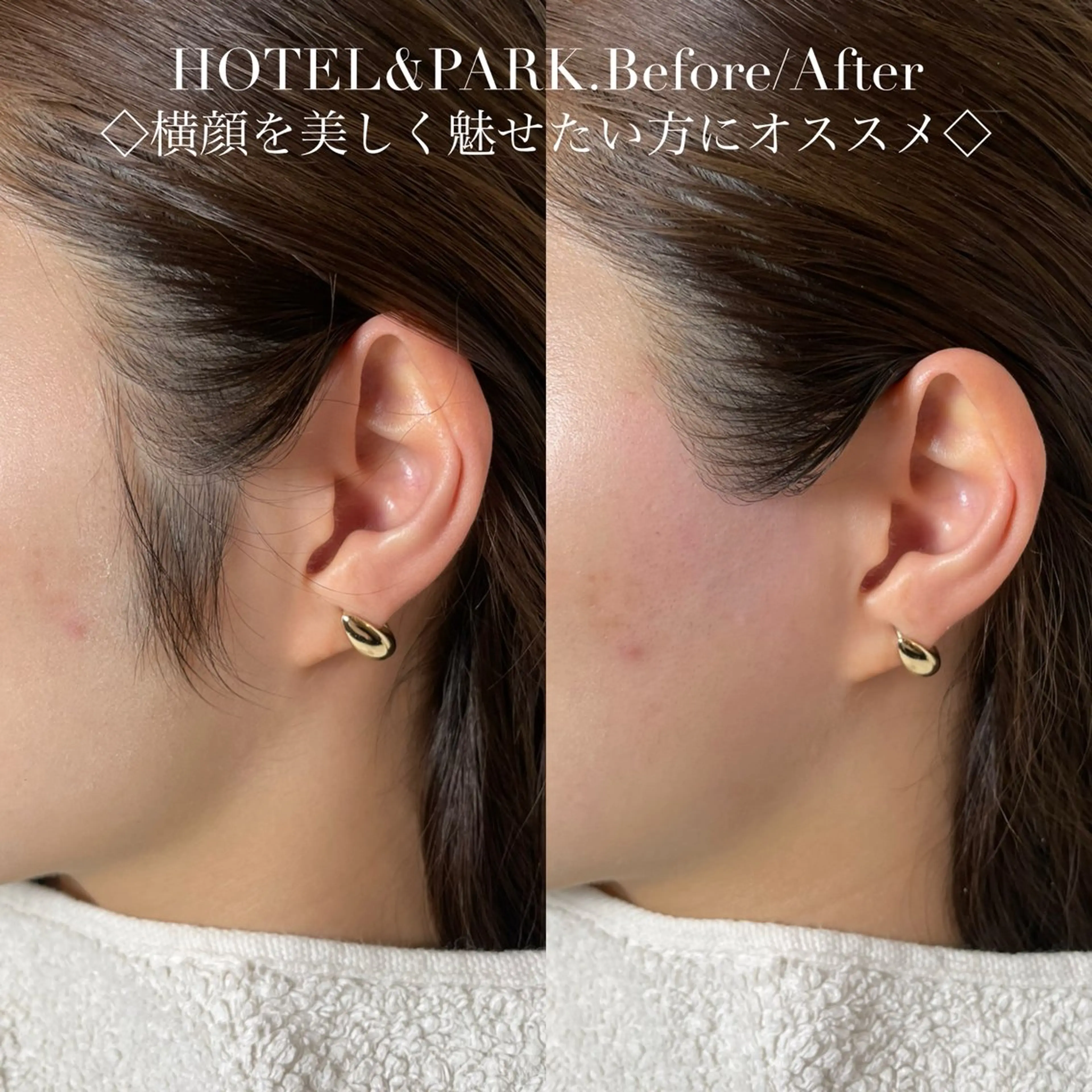 脱毛 HOTEL&PARK Mikuワックス脱毛のエステ・リラクイメージ