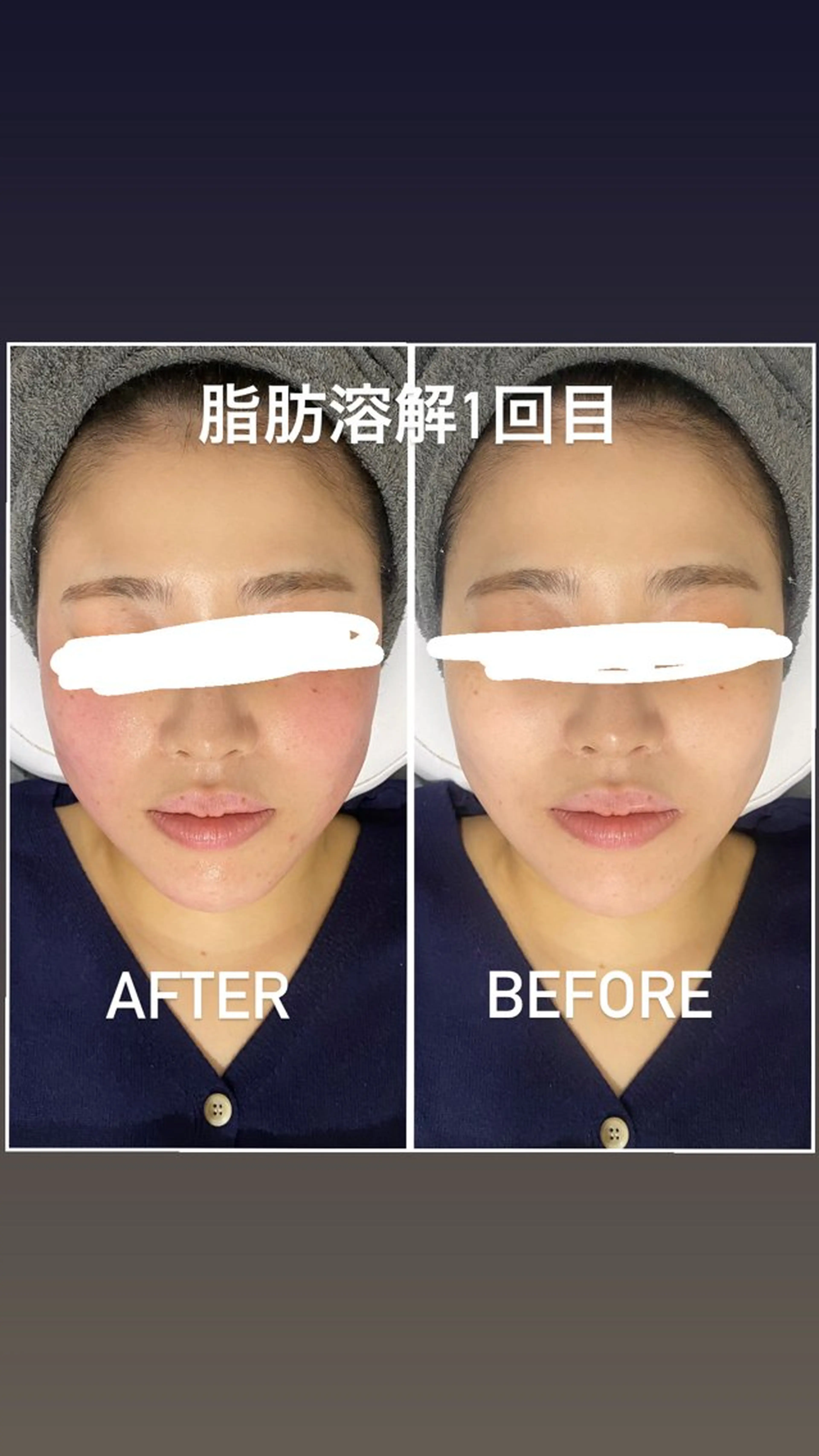 エステ 毛穴洗浄・痩身・脱毛 /アルカンジュのエステ・リラクイメージ