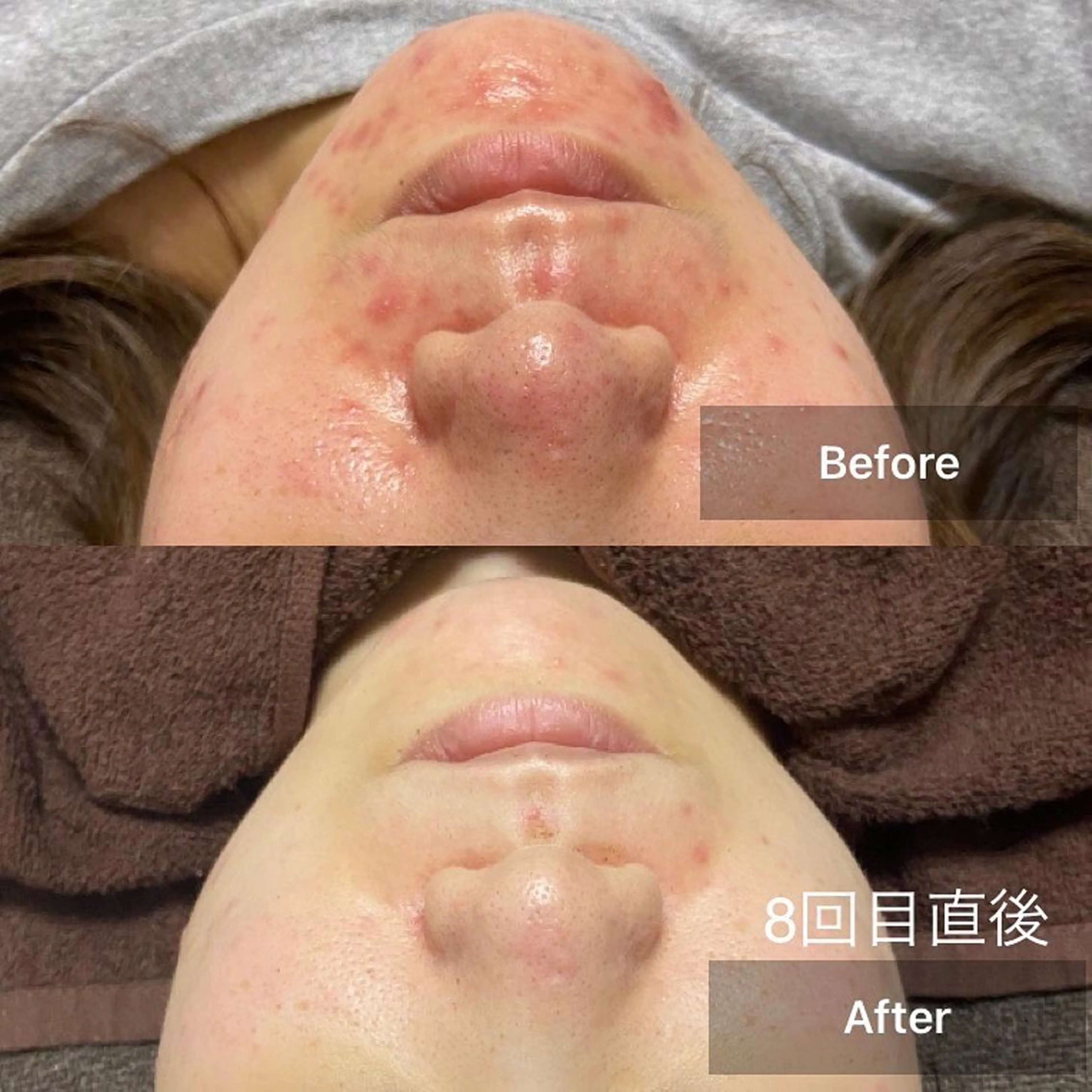 メンズ キッズ エステ 美肌と癒しのサロン Lu,Mieのエステ・リラクイメージ