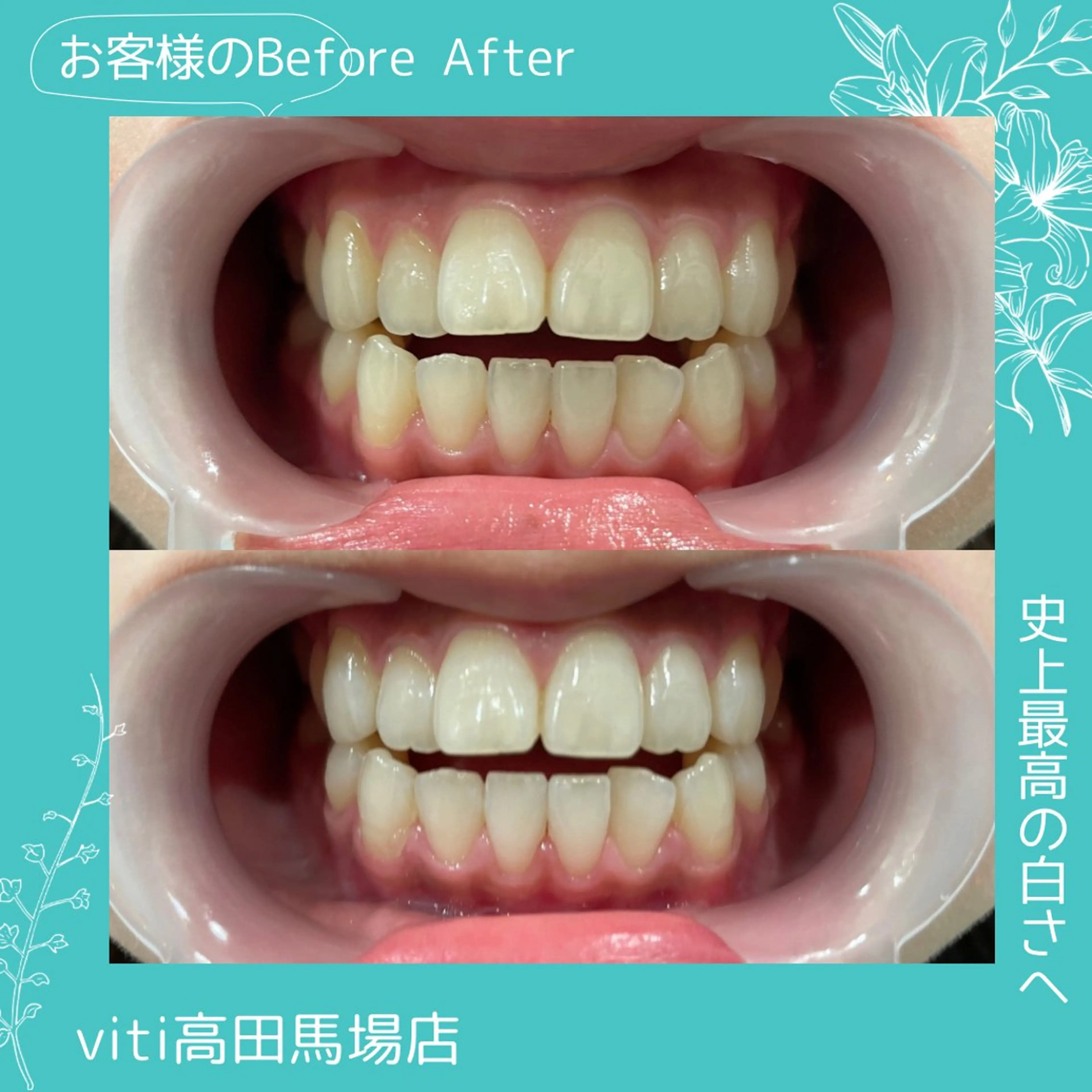 その他 viti 高田馬場店のその他イメージ