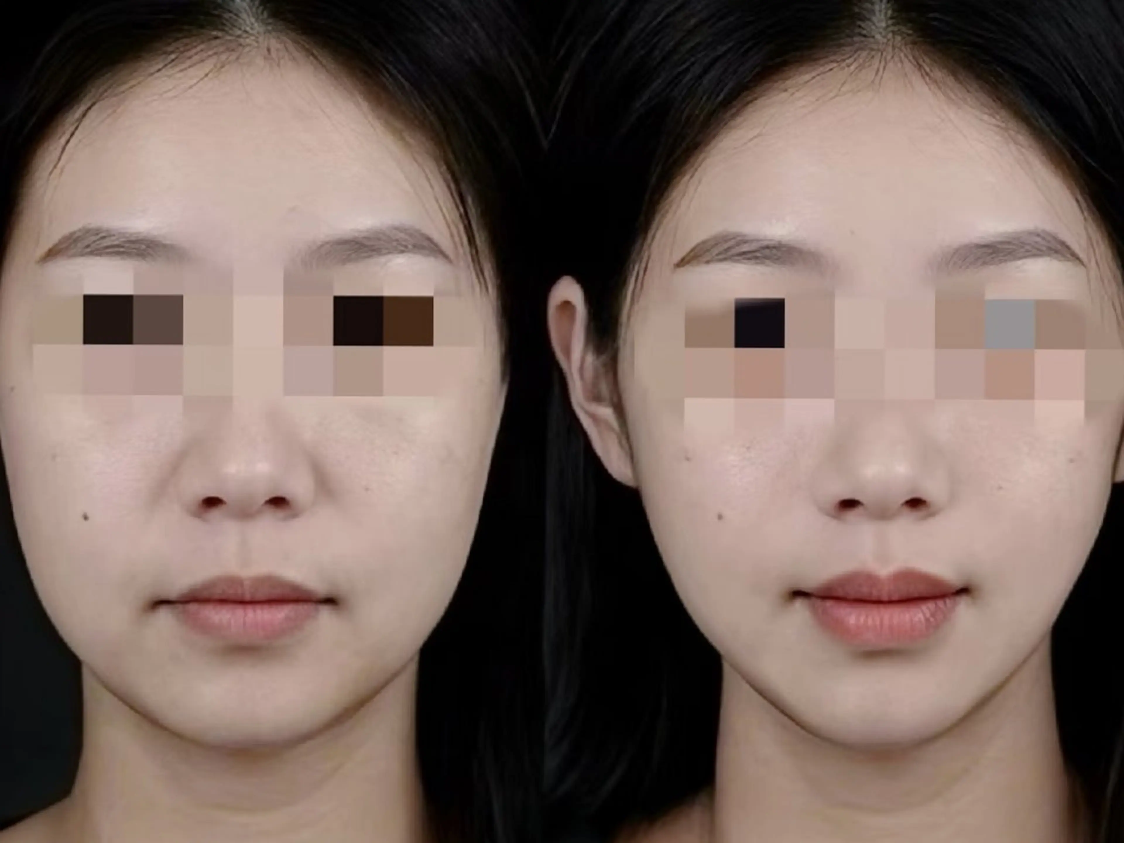 aliaハーブ水光店 エステティシャン募集のエステ・リラクイメージ