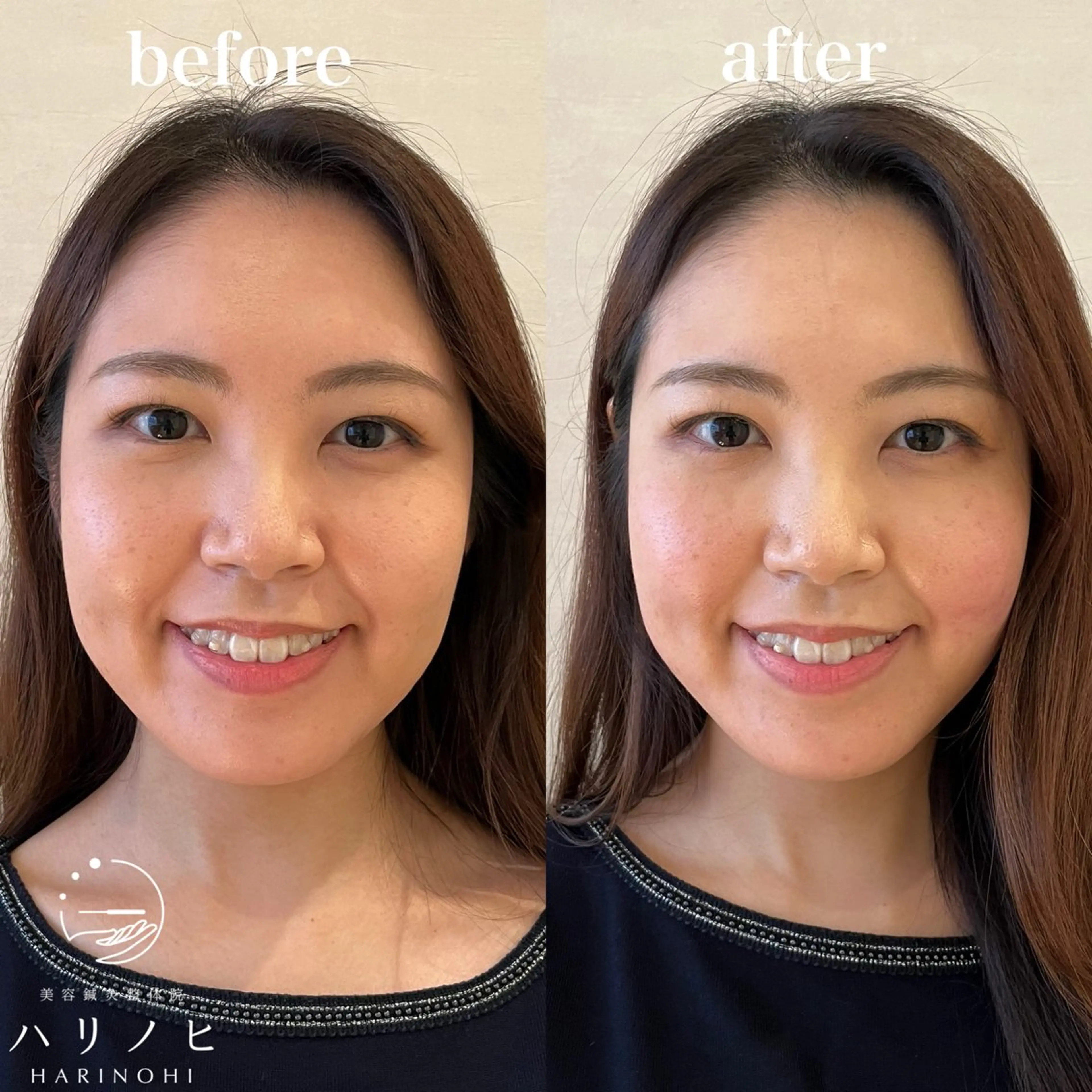 エステ リラク 美容鍼灸整体院 ハリノヒ大阪院のエステ・リラクイメージ