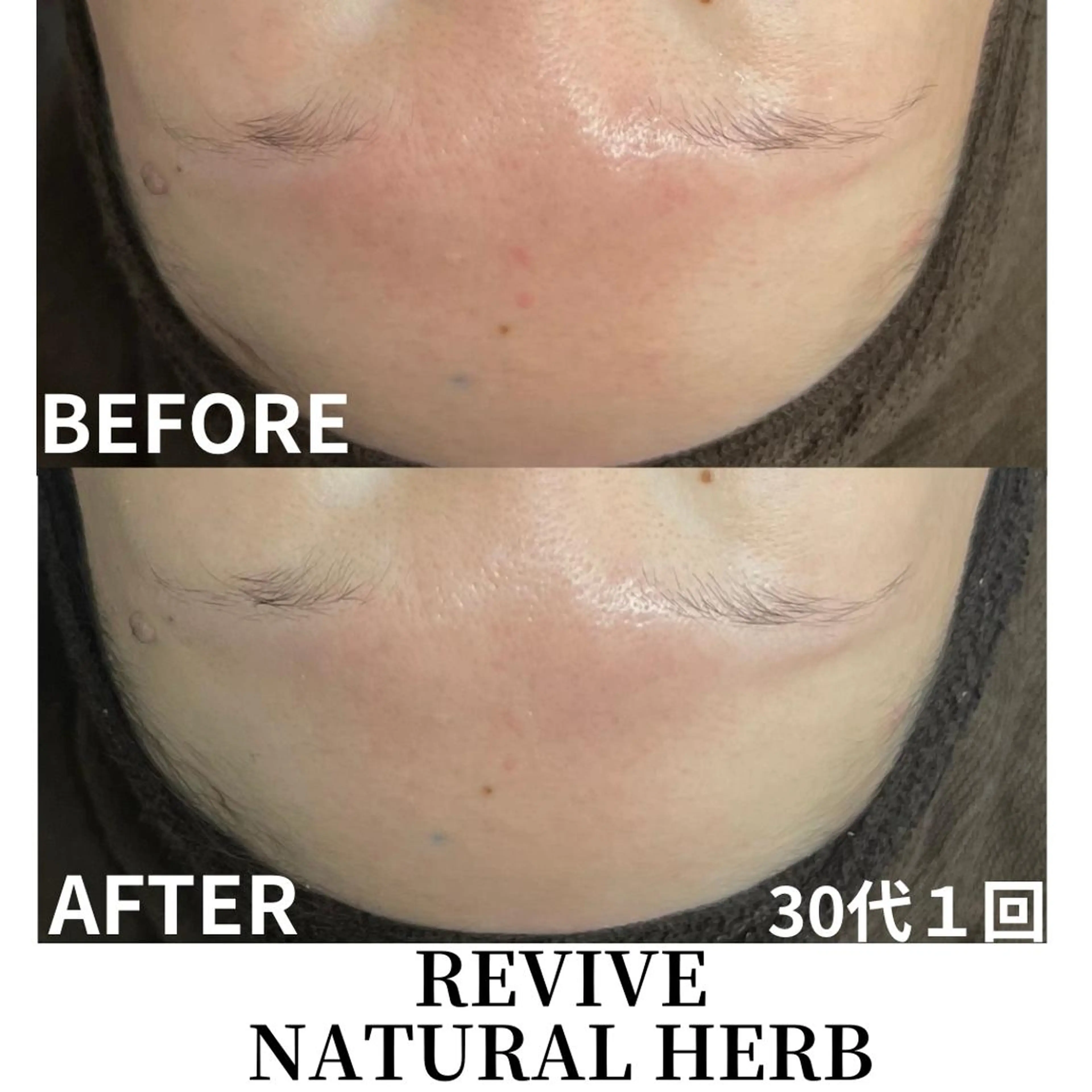 エステ PLACE梅田堂山店 【肌質改善/ハーブ】のエステ・リラクイメージ