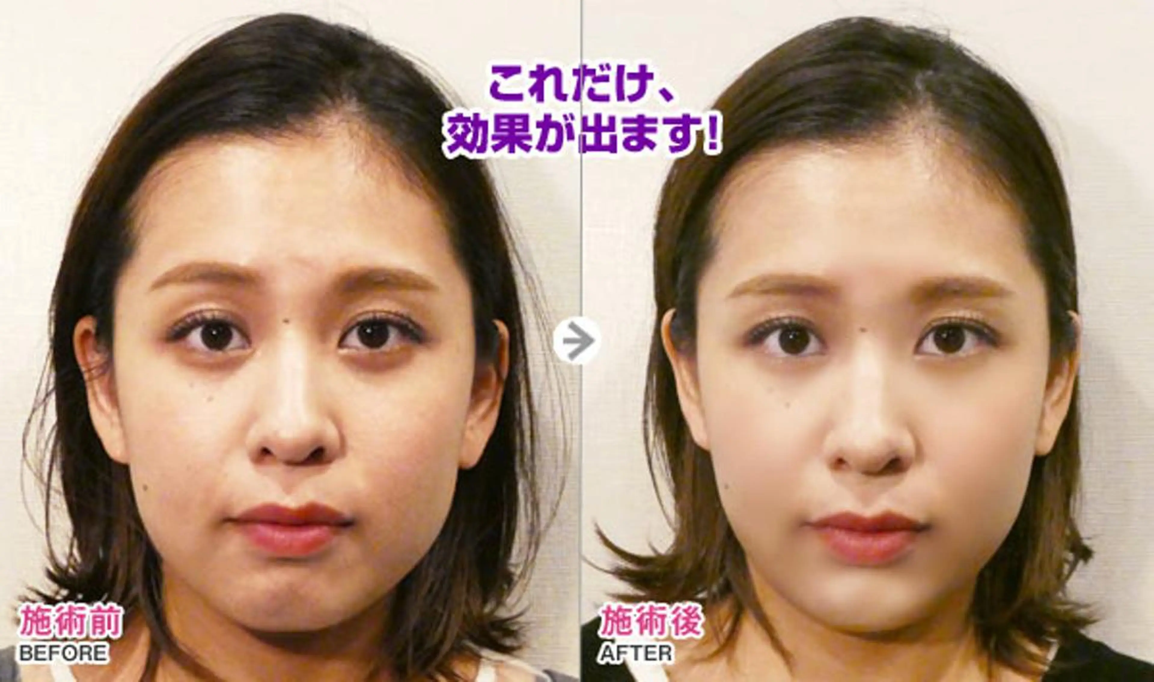 西区九条エステ MITUREIサロンのエステ・リラクイメージ