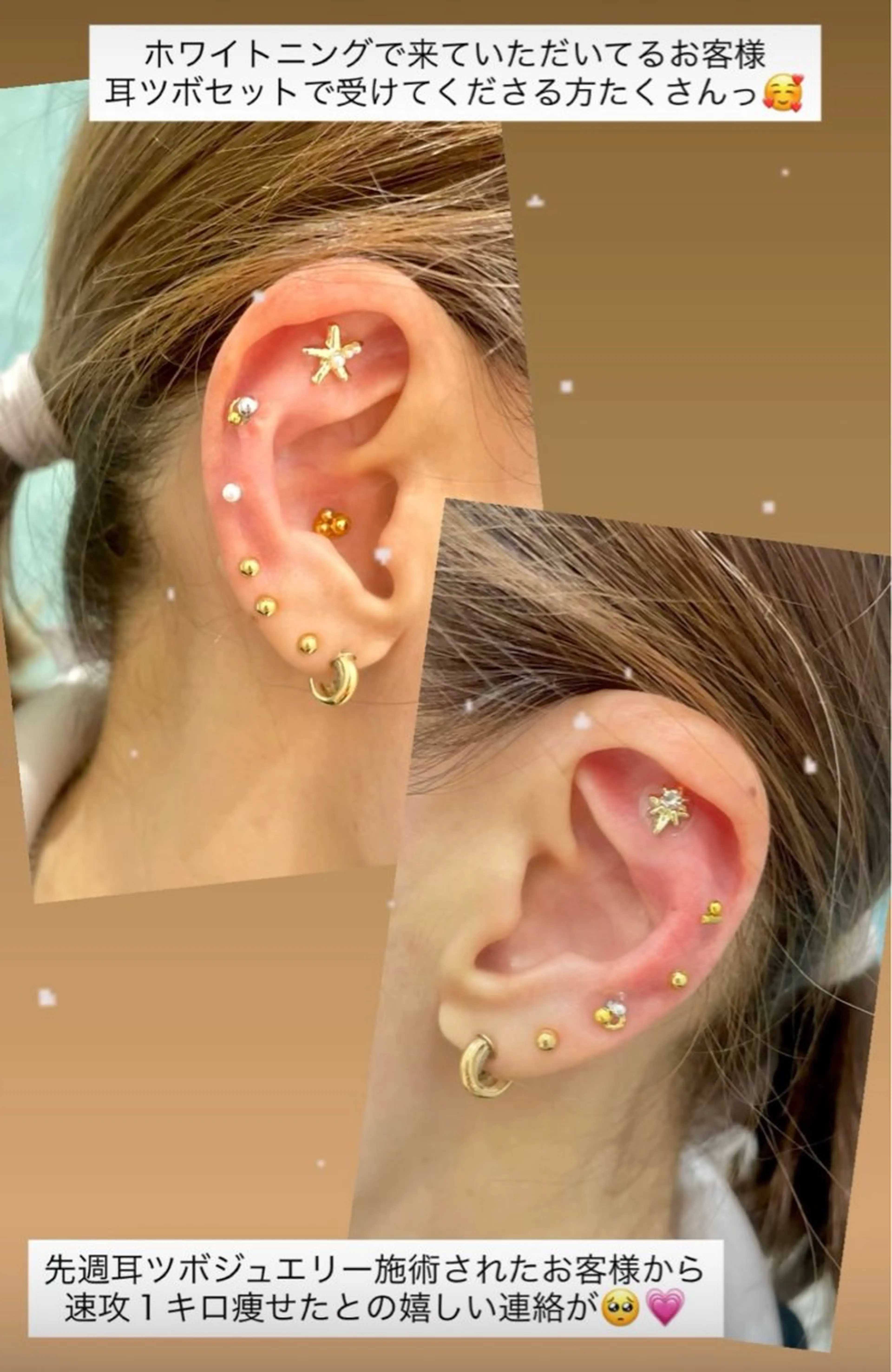 Kaula ホワイトニング🦷✨のエステ・リラクイメージ