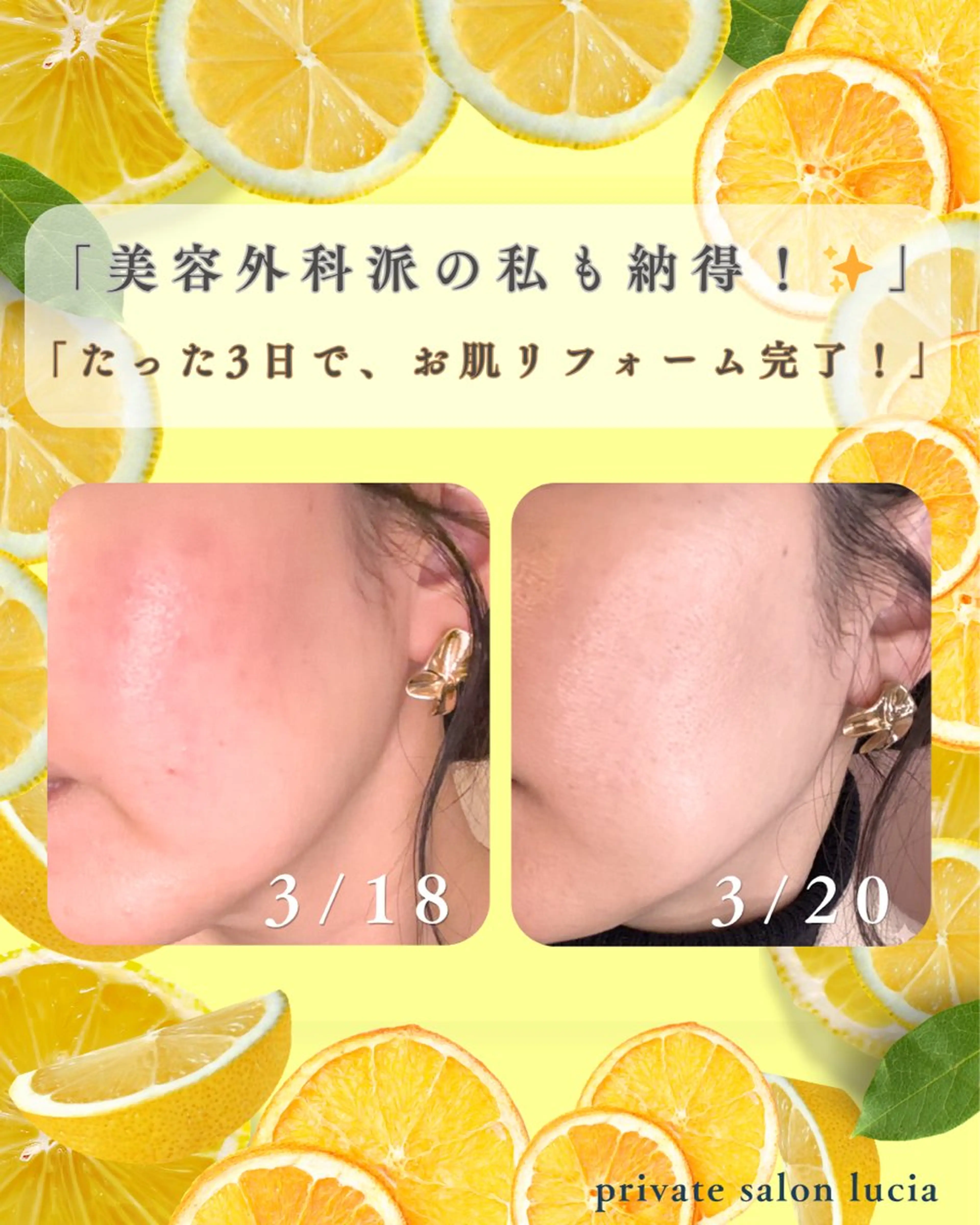 エステ lucia  豊明 肌管理のエステ・リラクイメージ