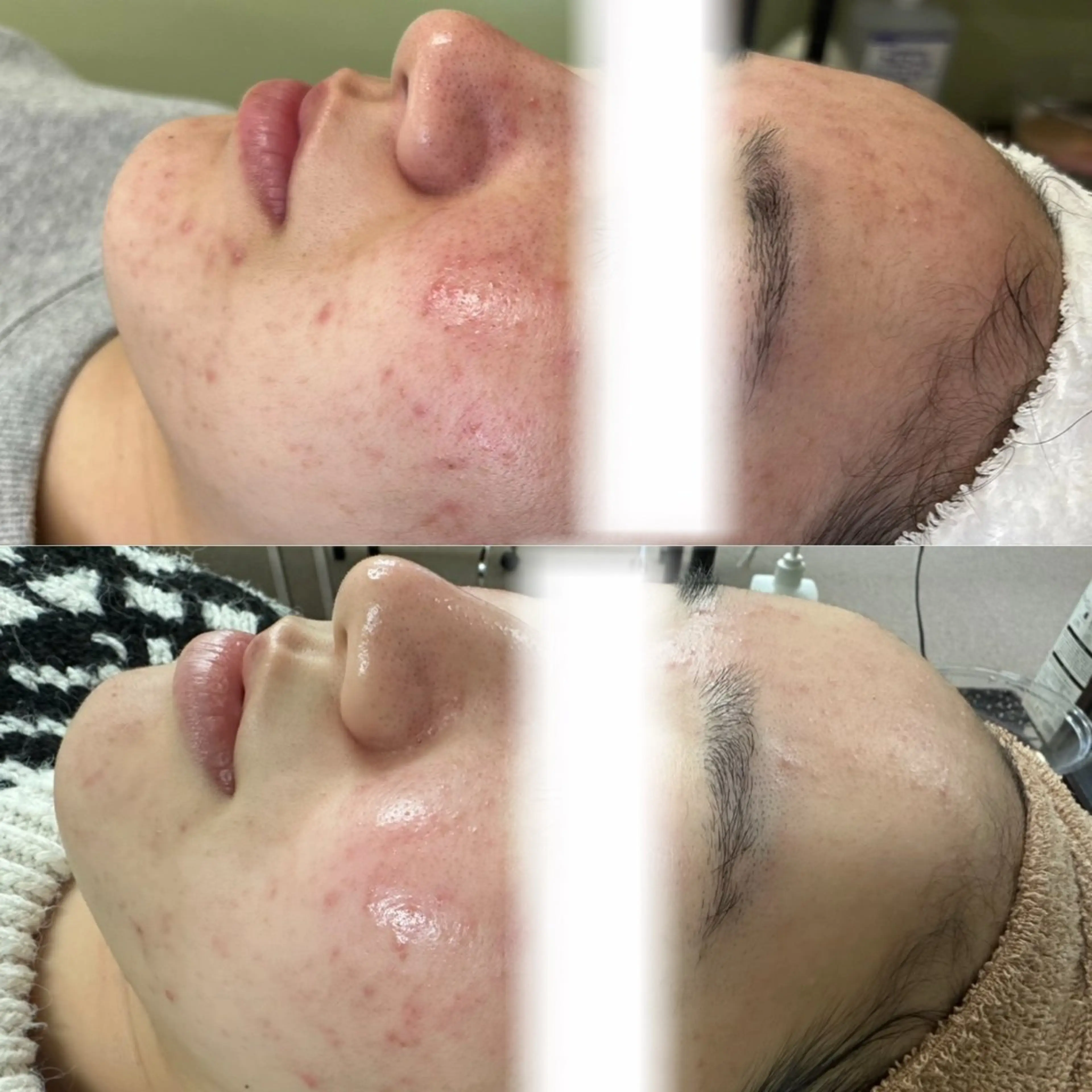 エステ 舘野 はるかのエステ・リラクイメージ