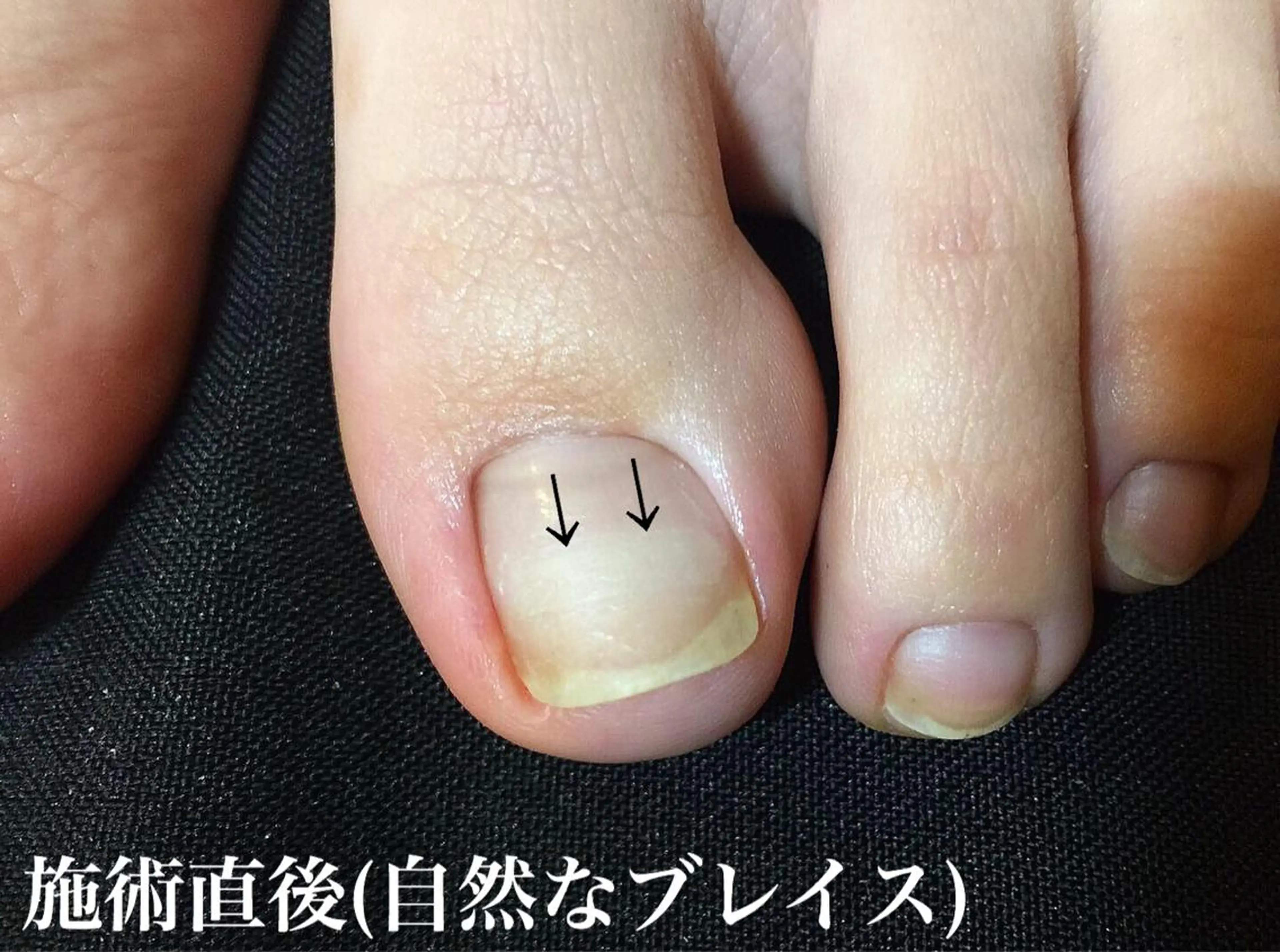 ネイル Viseo《6週間 長持ちパラジェル》のネイルデザイン