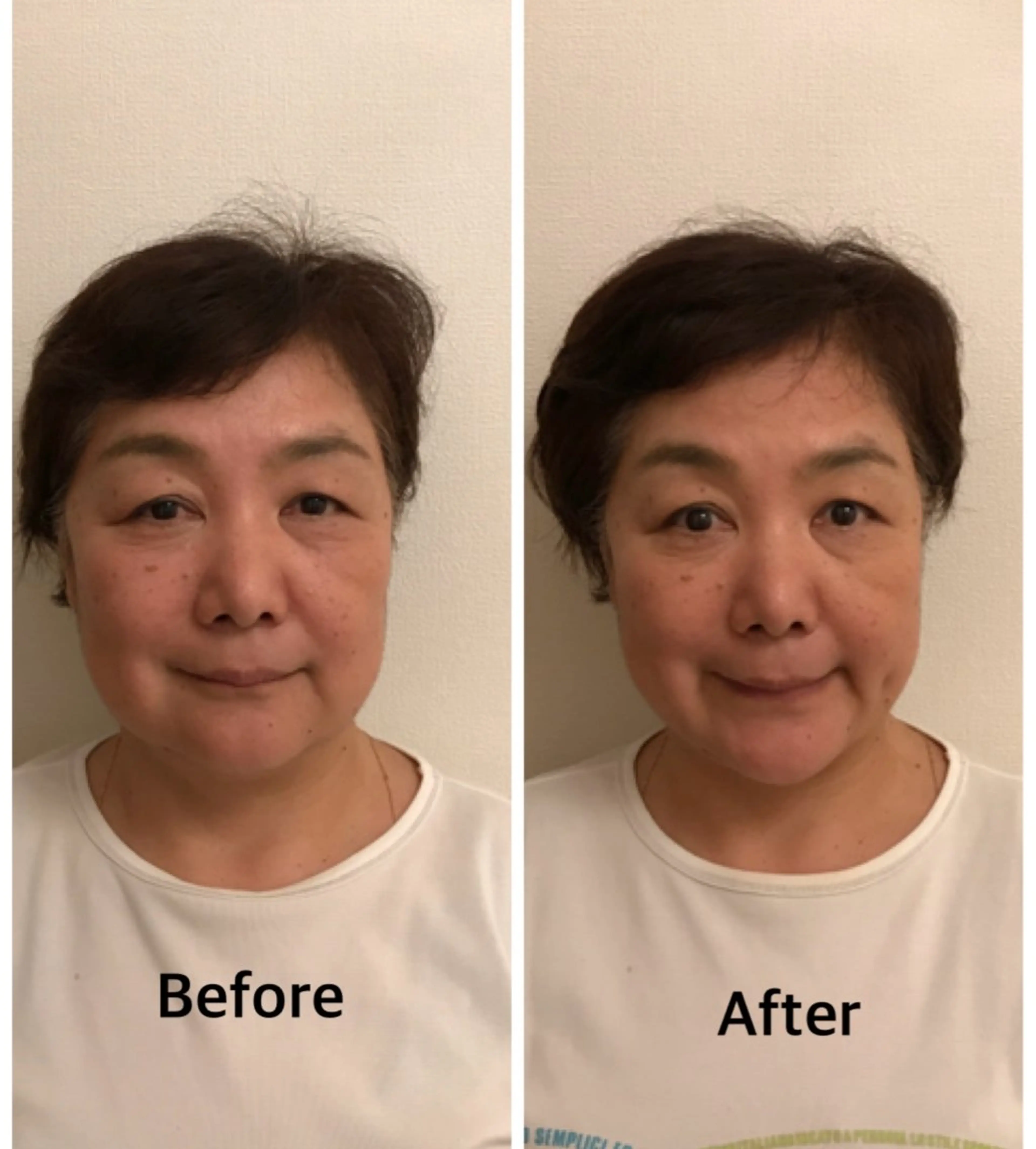 エステ リラク 町田・鶴川 小顔矯正 /鈴木友実のエステ・リラクイメージ