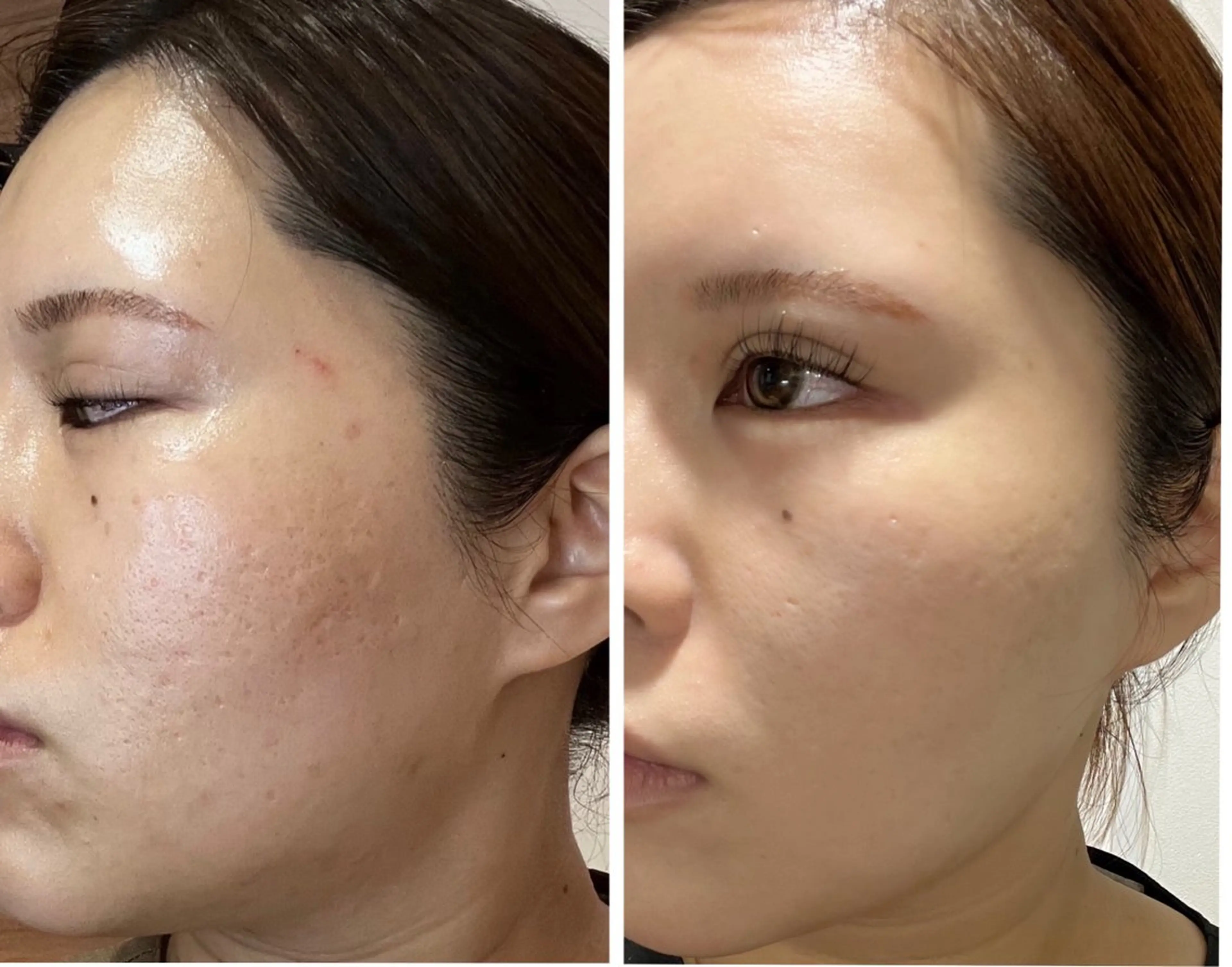 💎うる艶肌💎 スズキのエステ・リラクイメージ