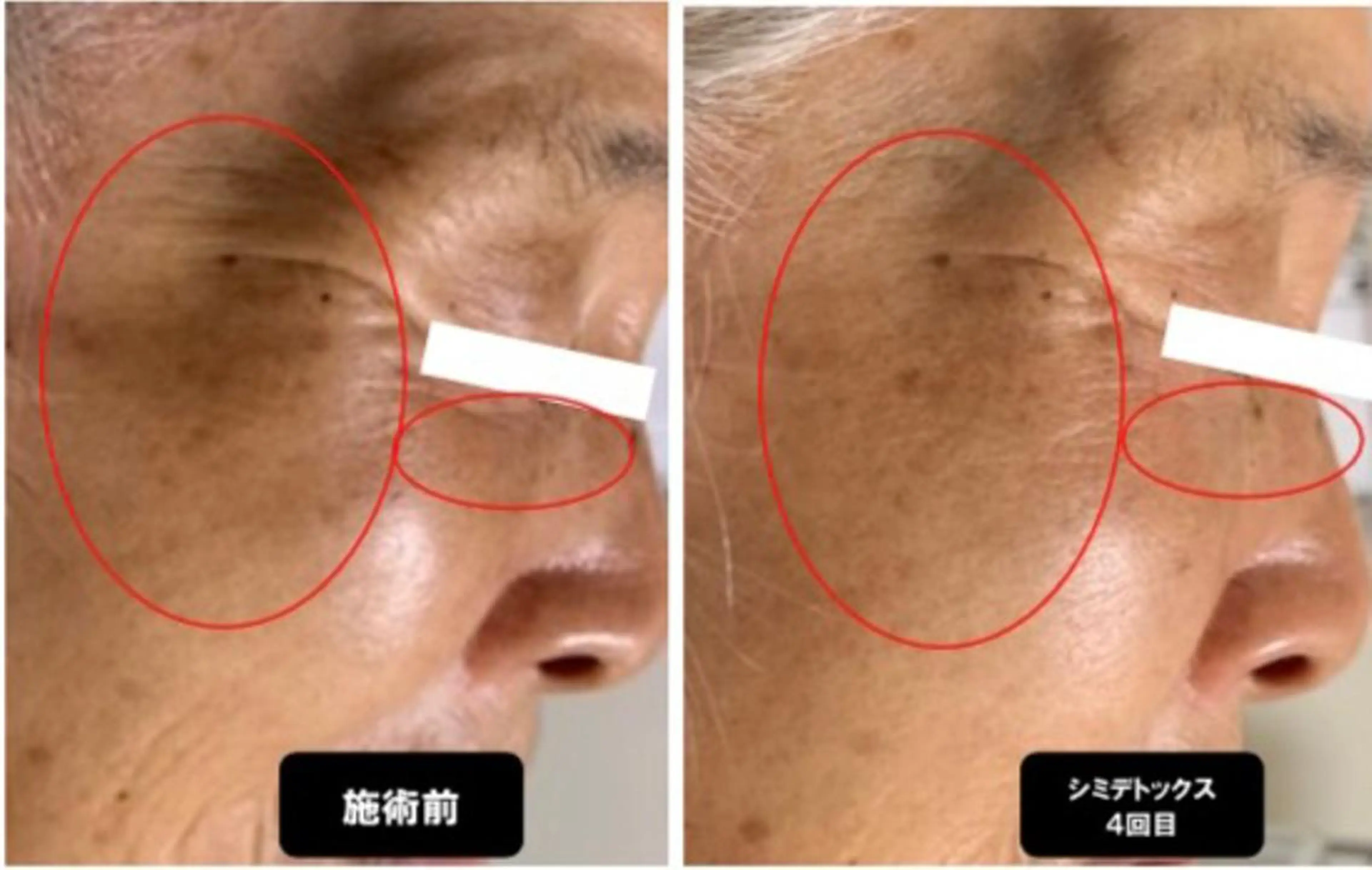 エステ ヴィーナス ビューティーのエステ・リラクイメージ