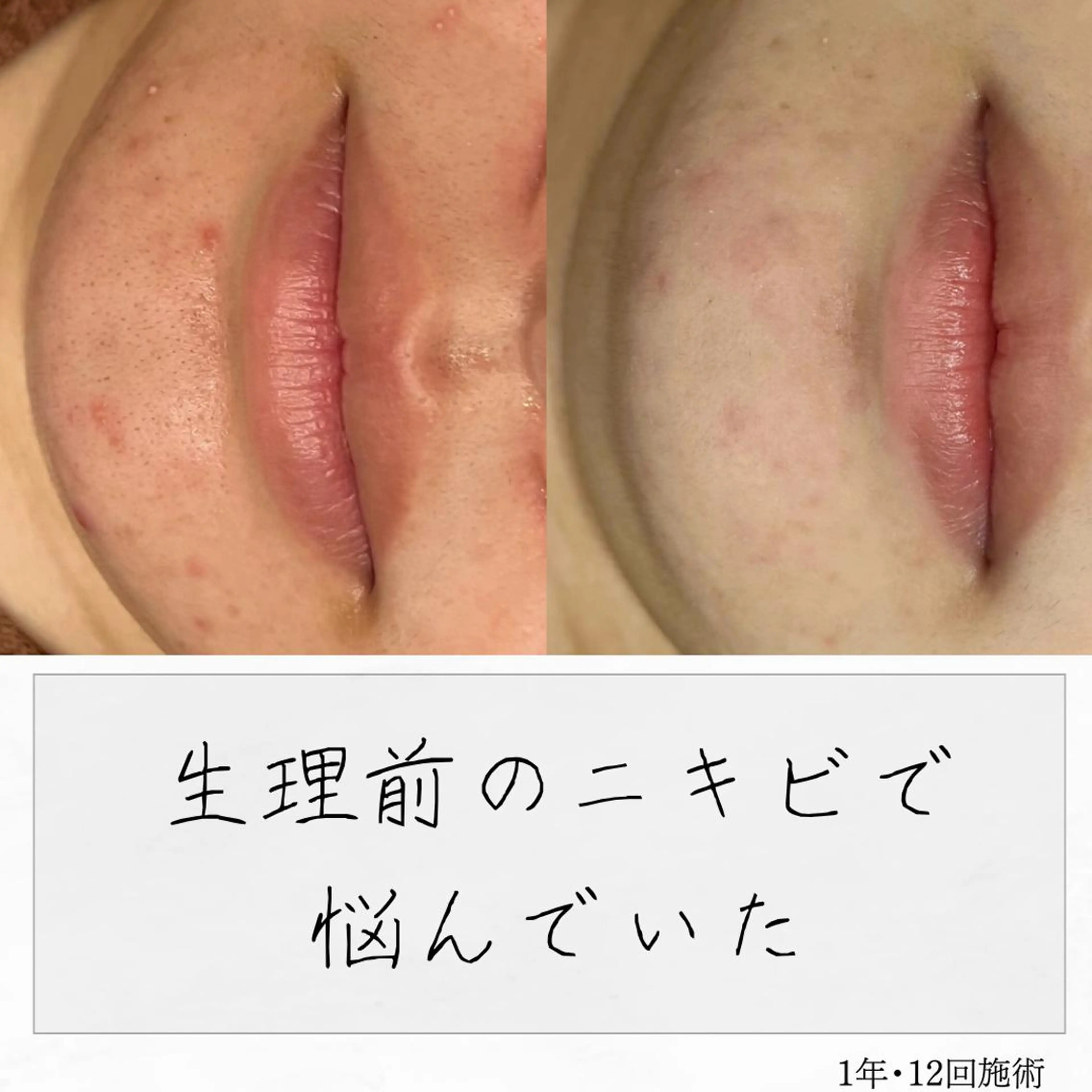 ニキビ経験者が施術 する専門サロン🌻のエステ・リラクイメージ