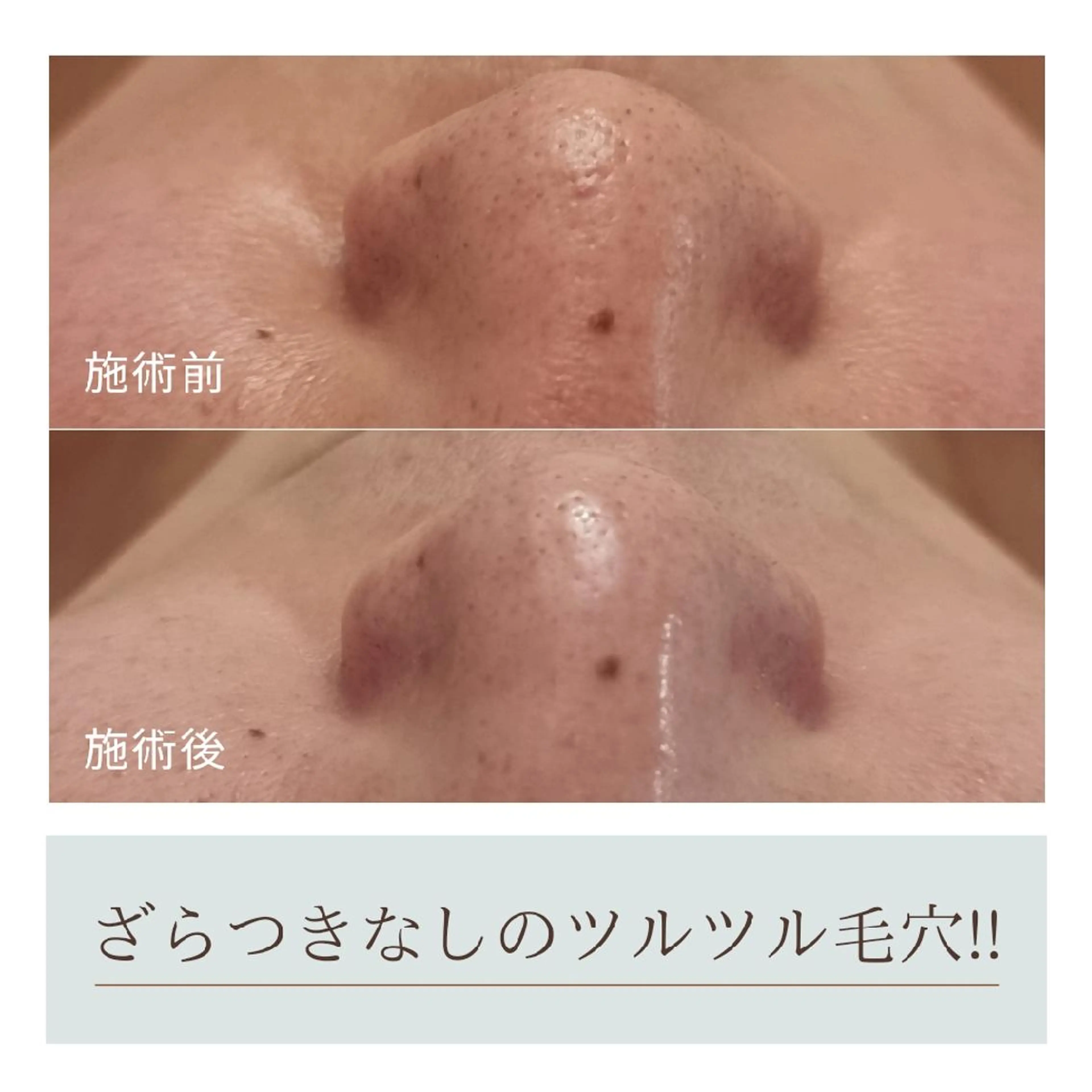 Beauty&Spa Chloe のエステ・リラクイメージ