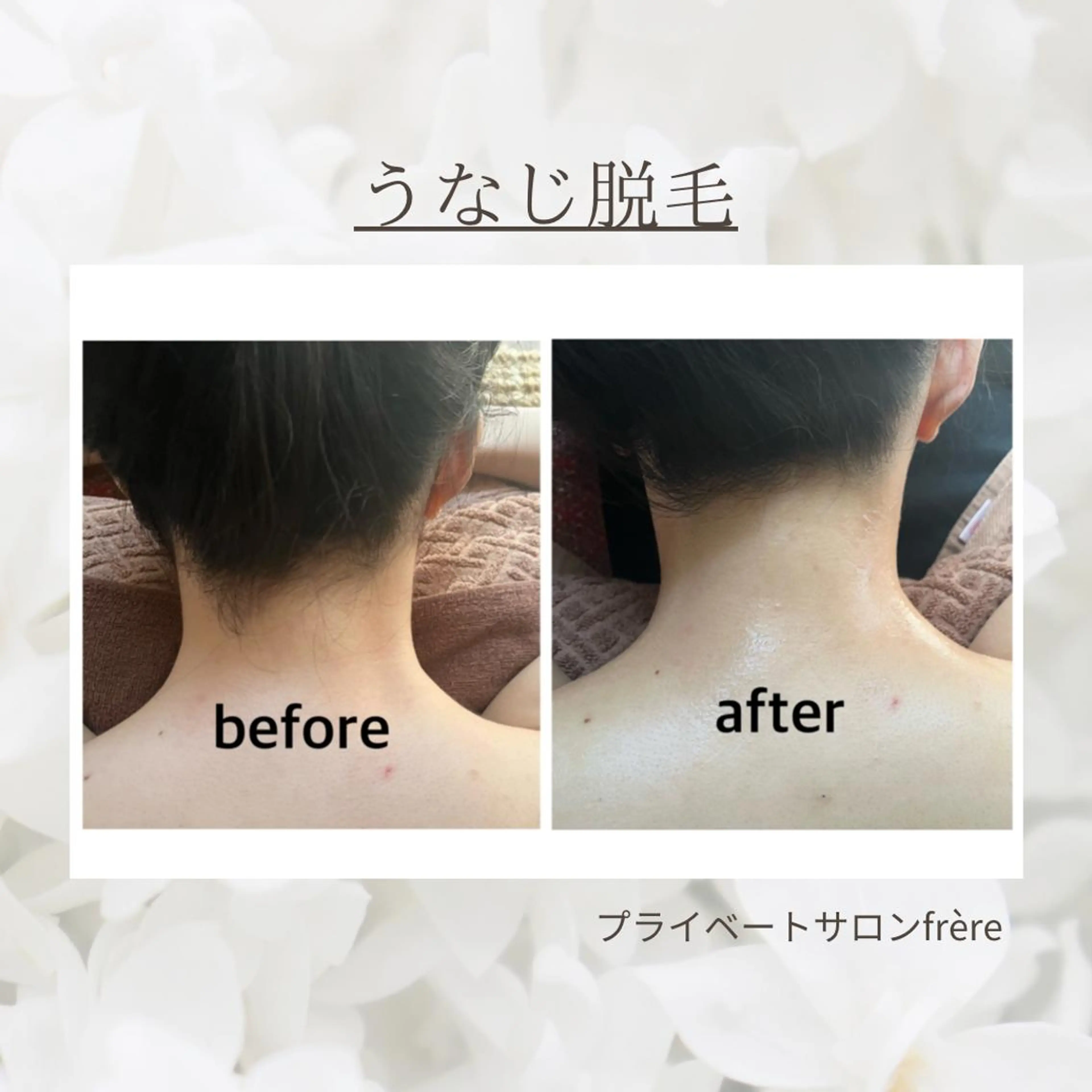 脱毛&ハーブピーリン グサロンfrereのその他イメージ