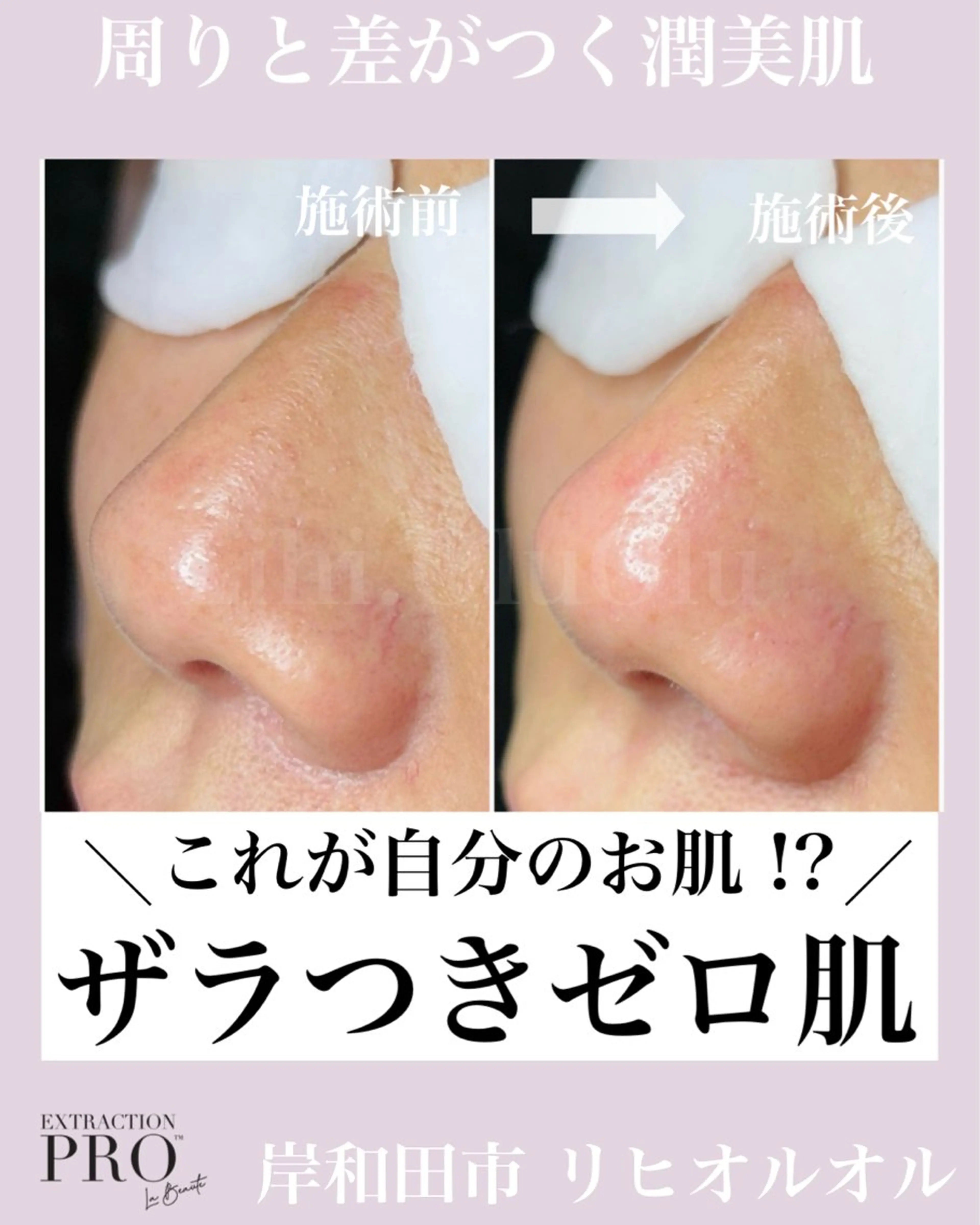 毛穴汚れ改善専門店/ 岸和田/リヒオルオルのエステ・リラクイメージ