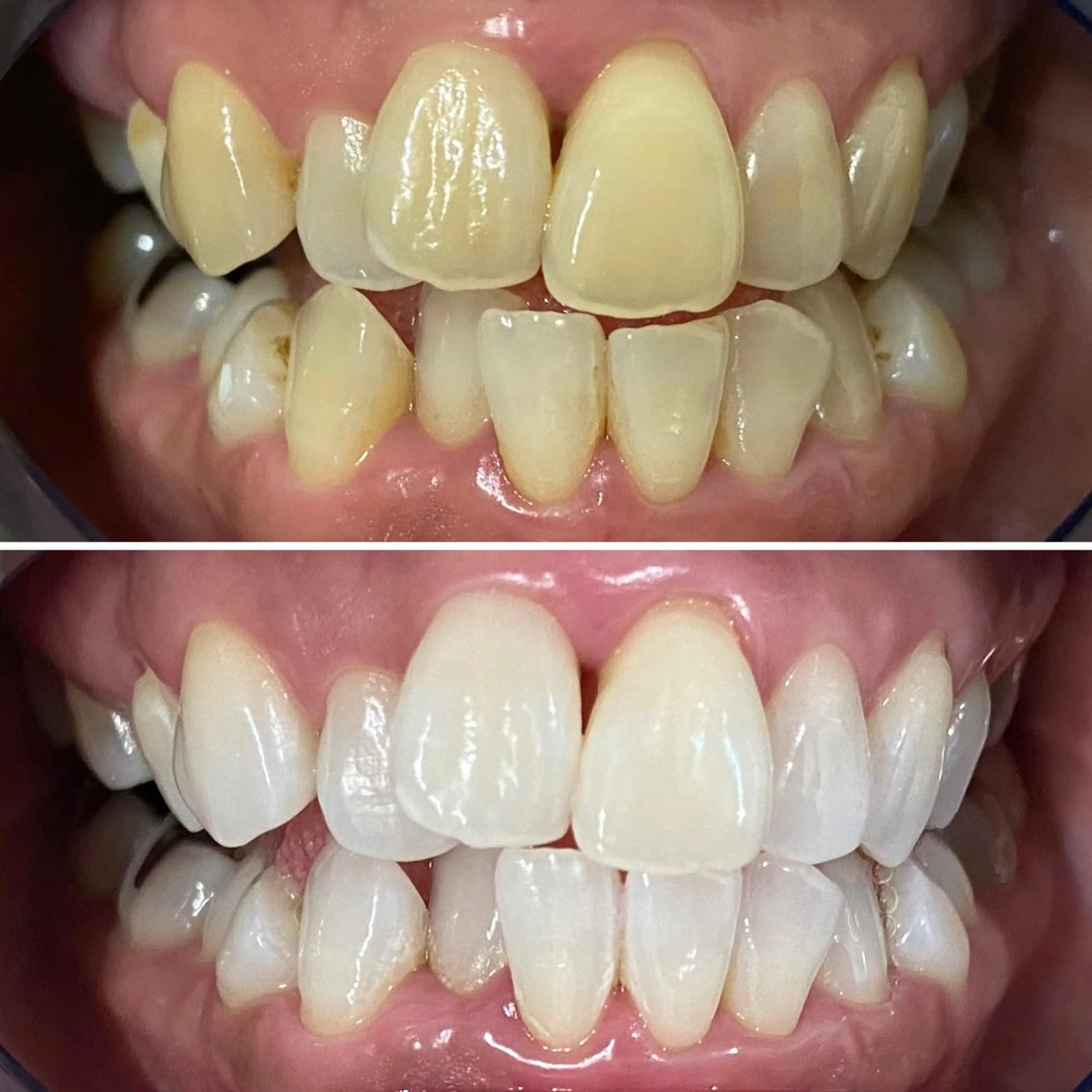 ホワイトニングサロン CREWのその他イメージ