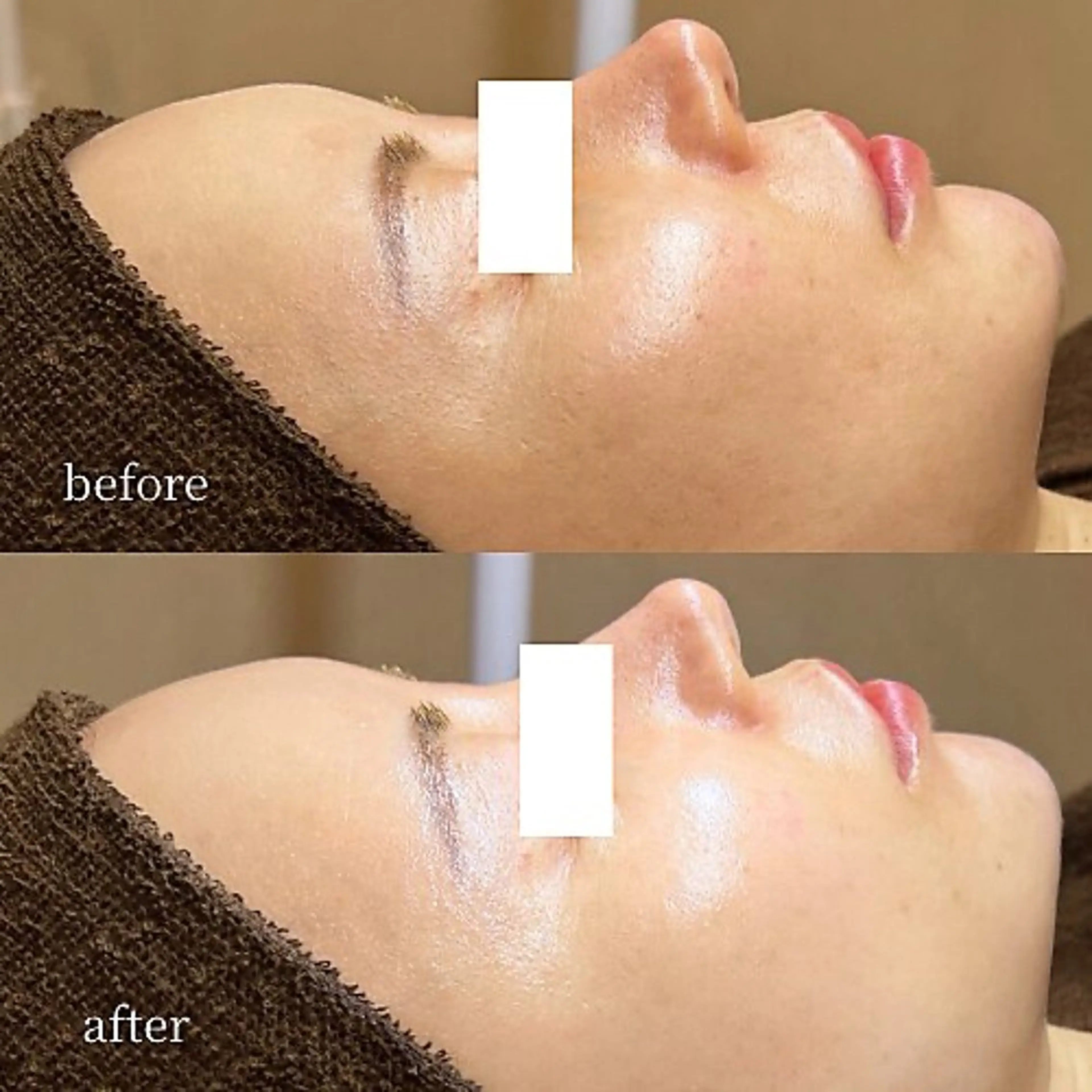 韓国肌管理・肌質改善 EARNEST心斎橋のエステ・リラクイメージ