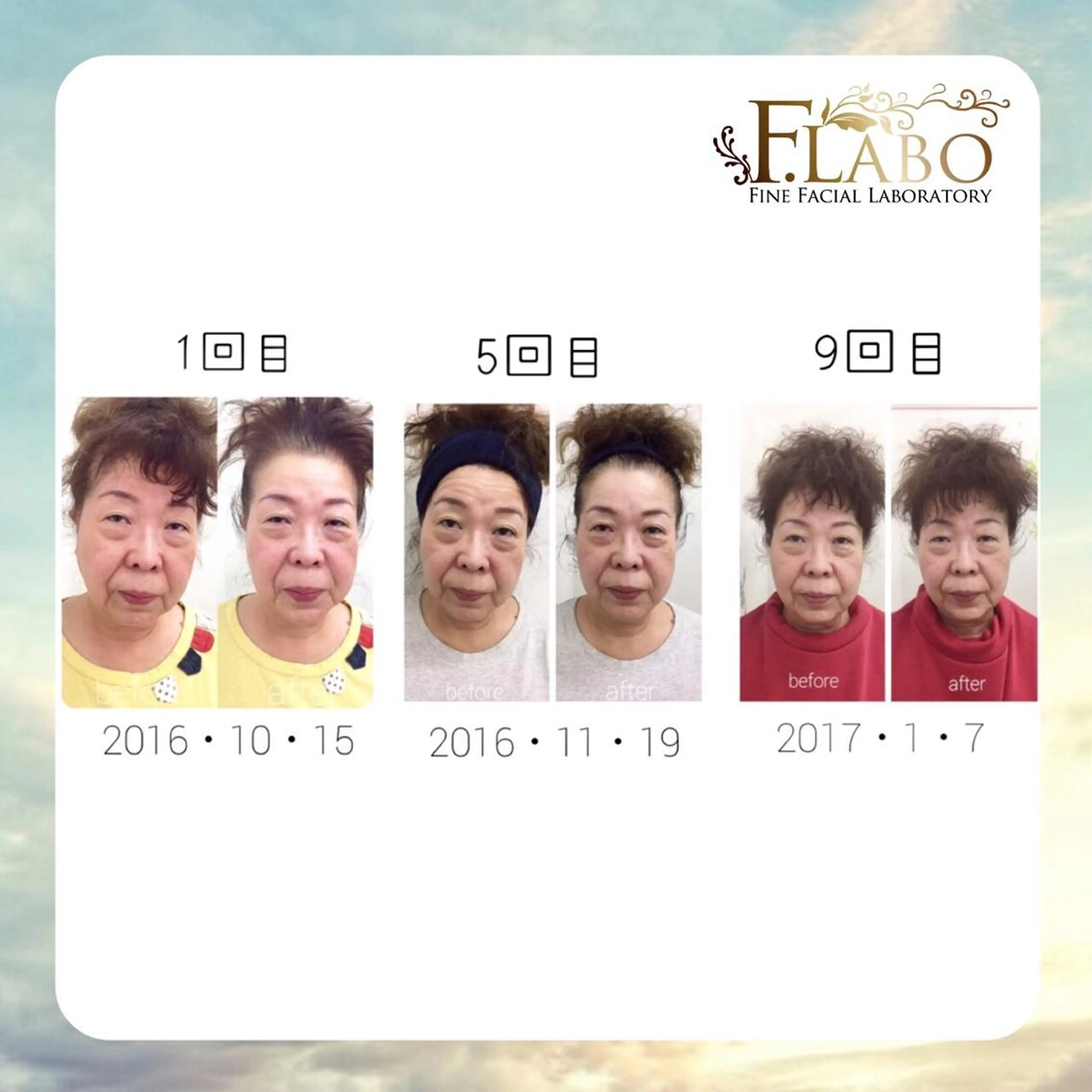 小顔&ダイエットジム エステ担当REIKOのその他イメージ