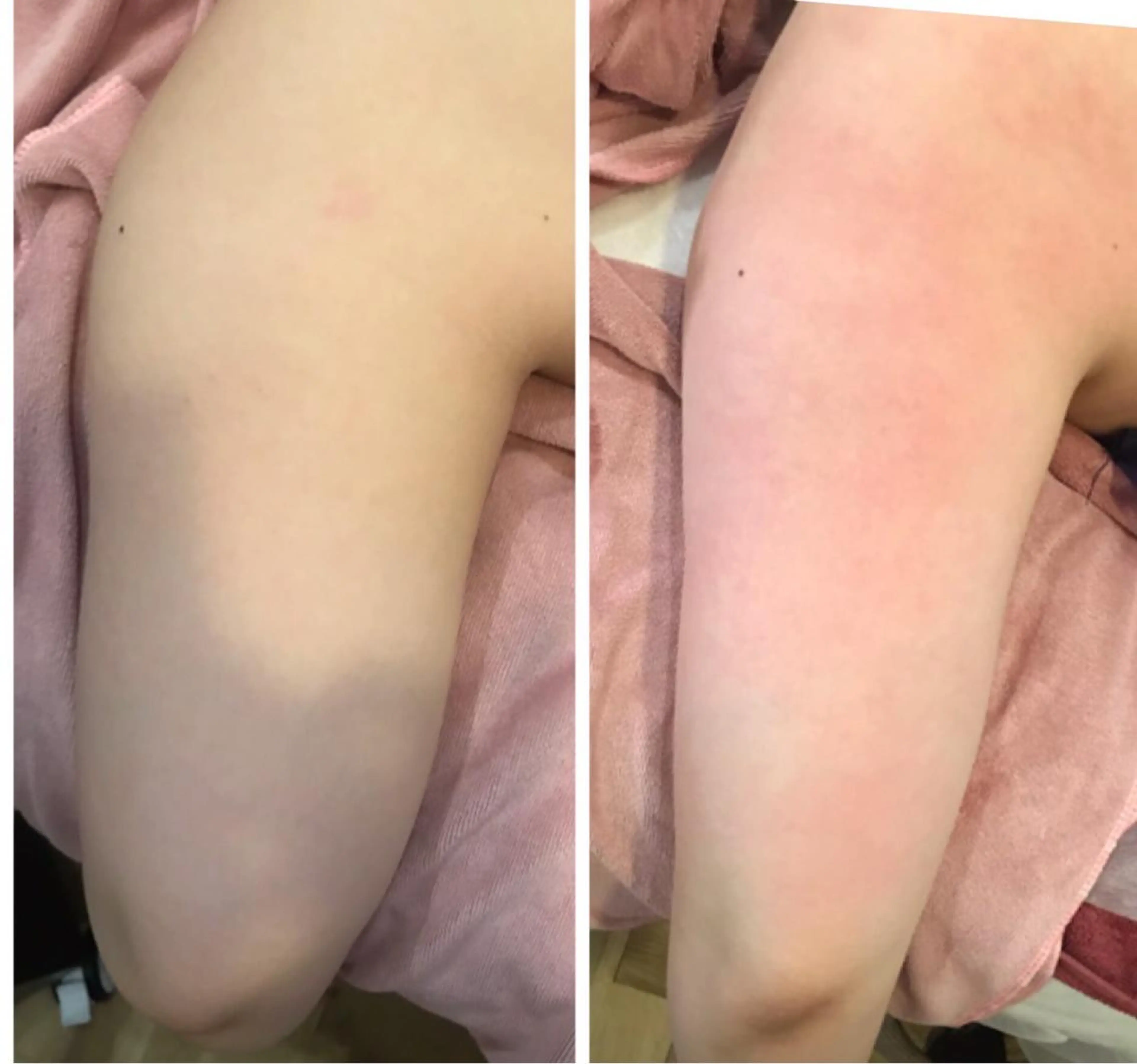 【ニキビ/肌管理】 salon varyのエステ・リラクイメージ