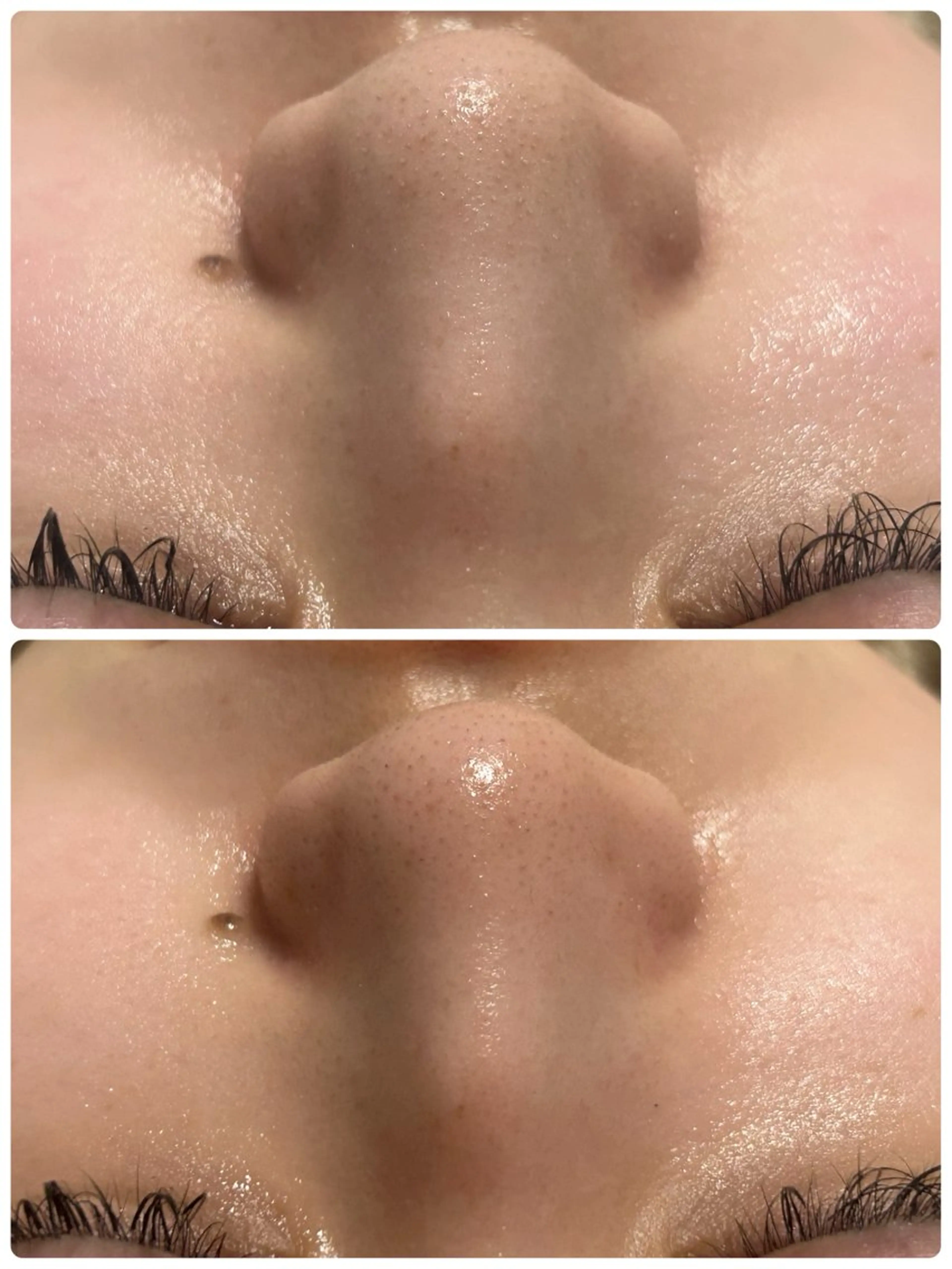 エステ フェイシャルサロン CHIARA 荒田のエステ・リラクイメージ