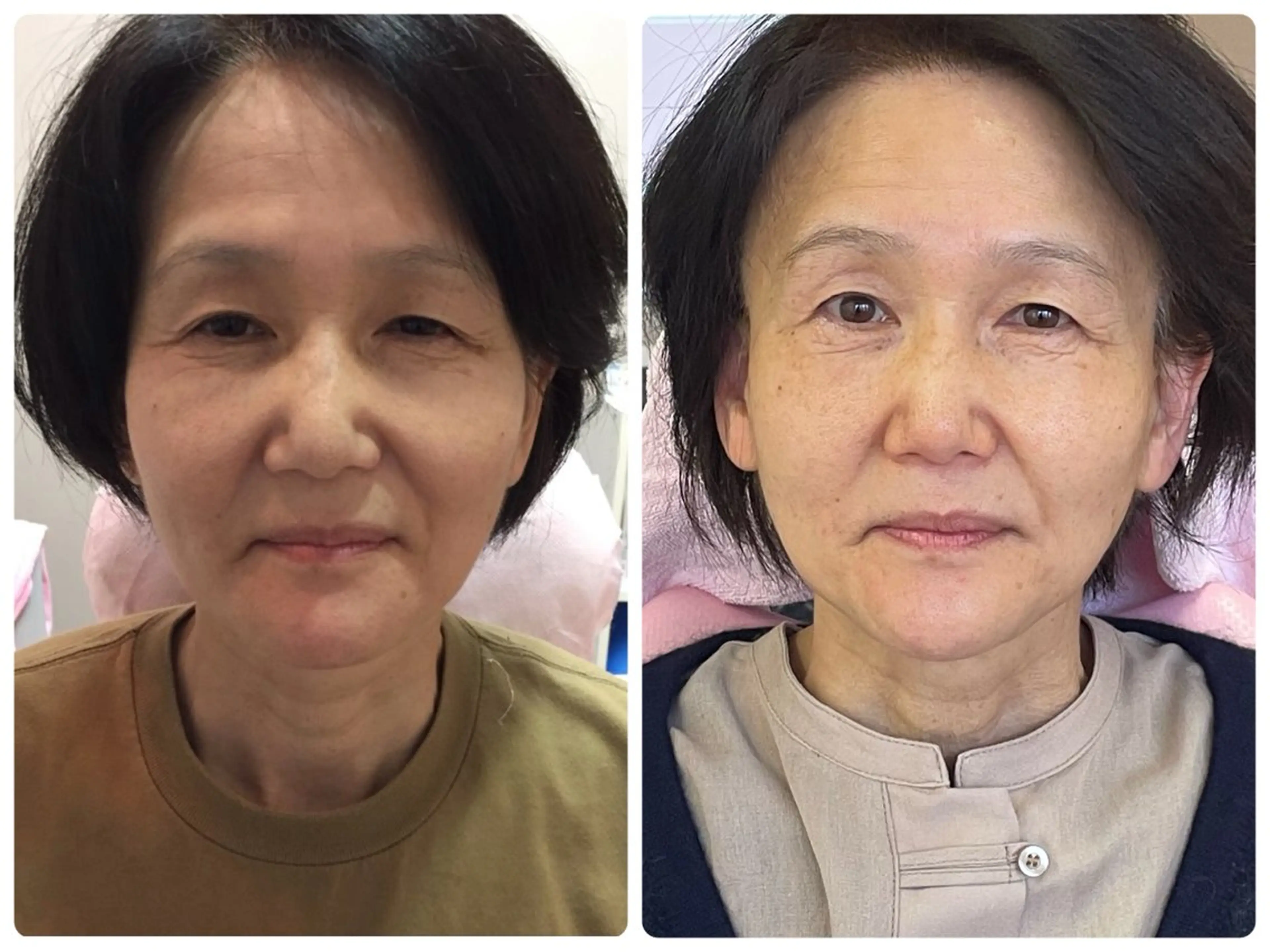 Salon Rion所属・Rion 野々村のエステ・リラクイメージ