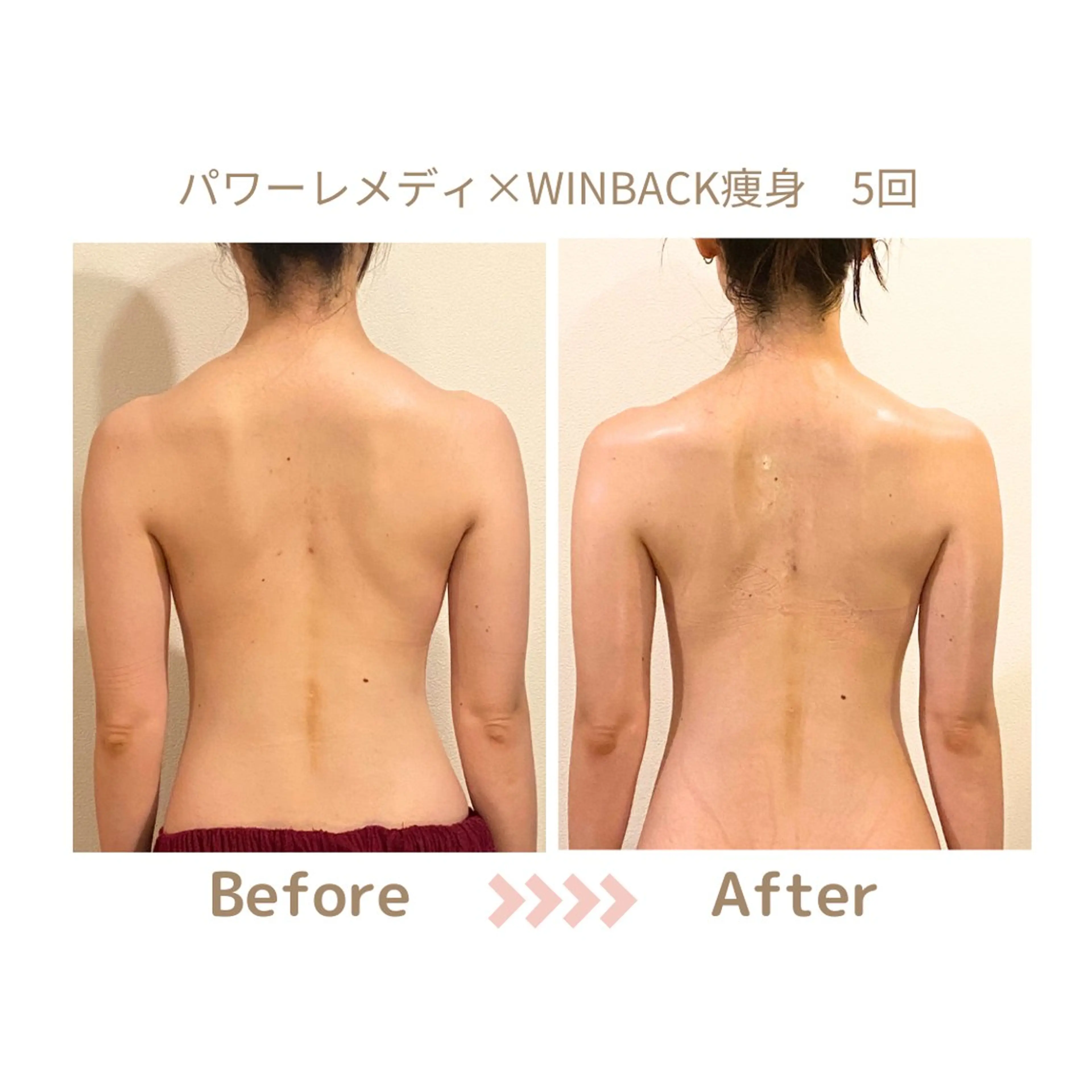 肌質改善×小顔サロン リトリト垣内のエステ・リラクイメージ