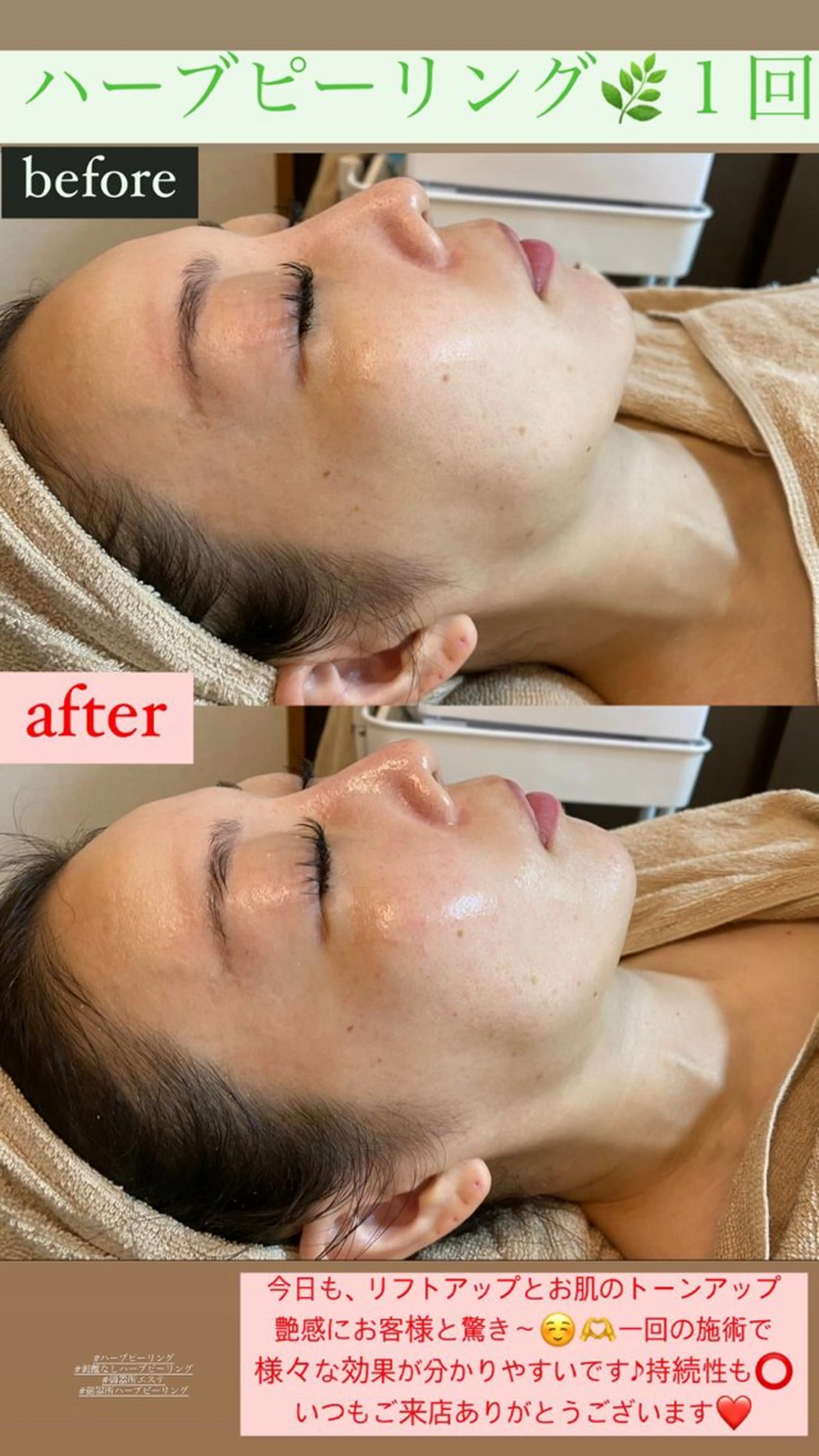 エステ Salon de Lino 御器所のエステ・リラクイメージ