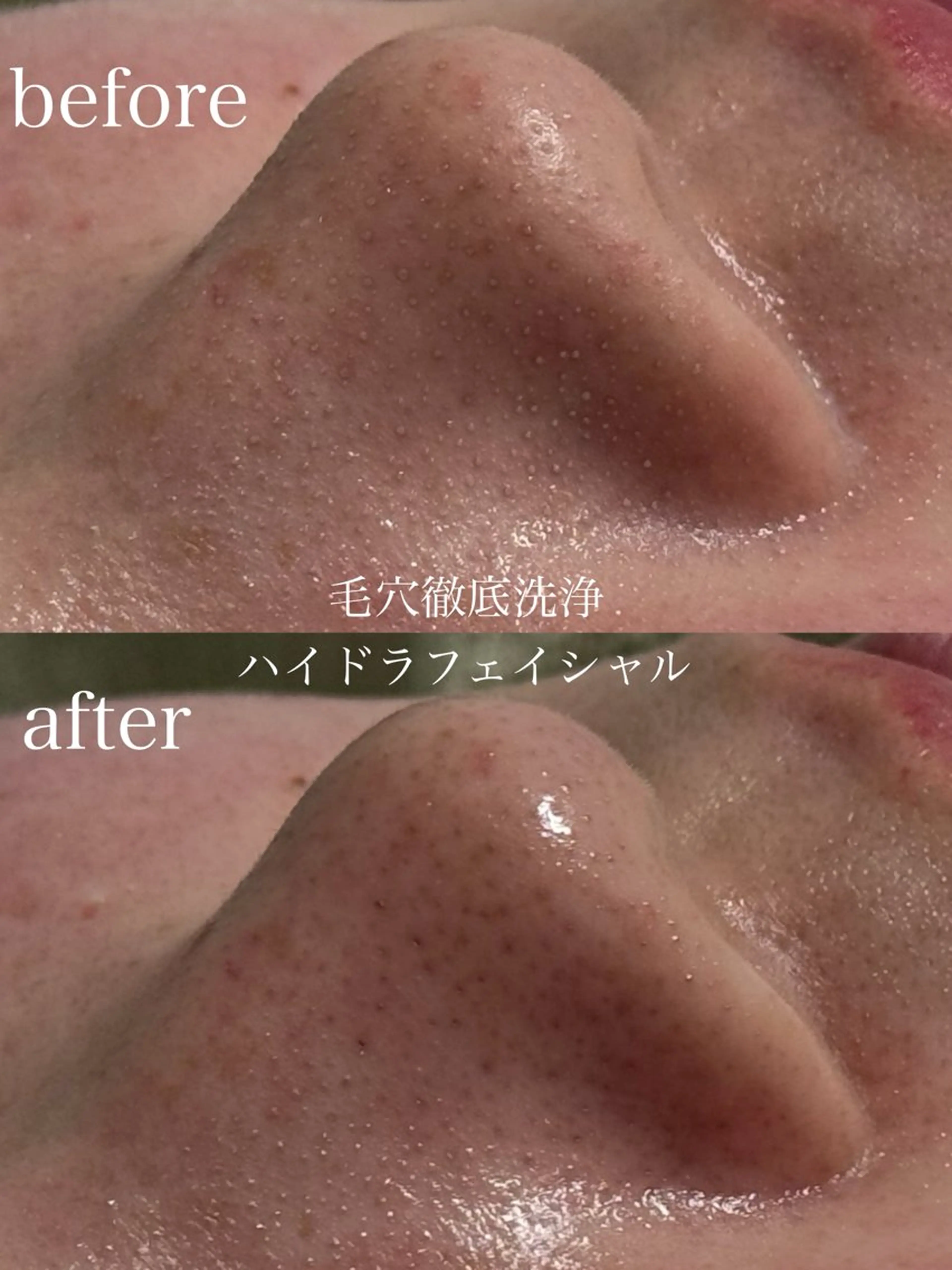 エステ フェイシャルサロン CHIARA鈴木のエステ・リラクイメージ