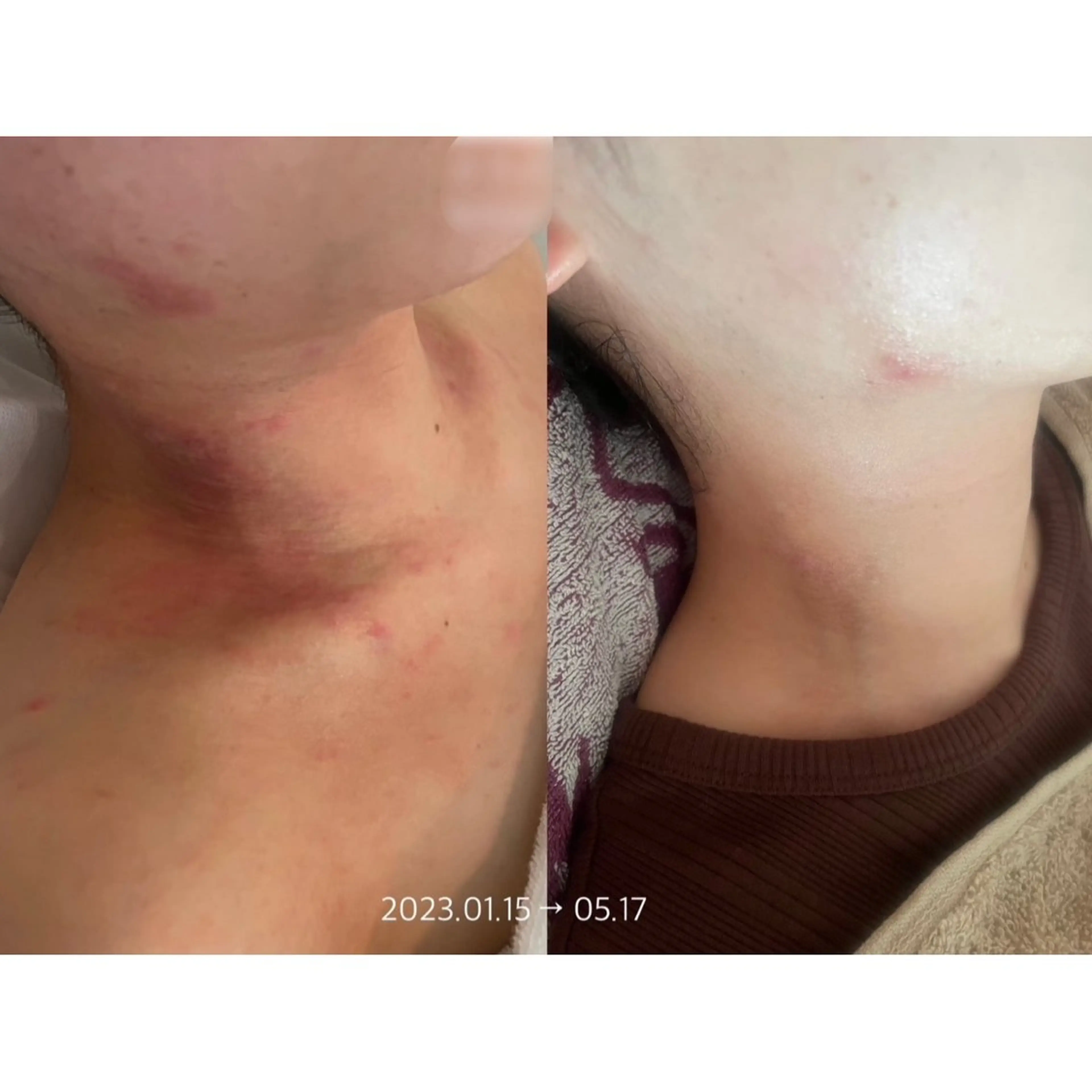 杉浦里沙⌇ 居心地いいエステのエステ・リラクイメージ