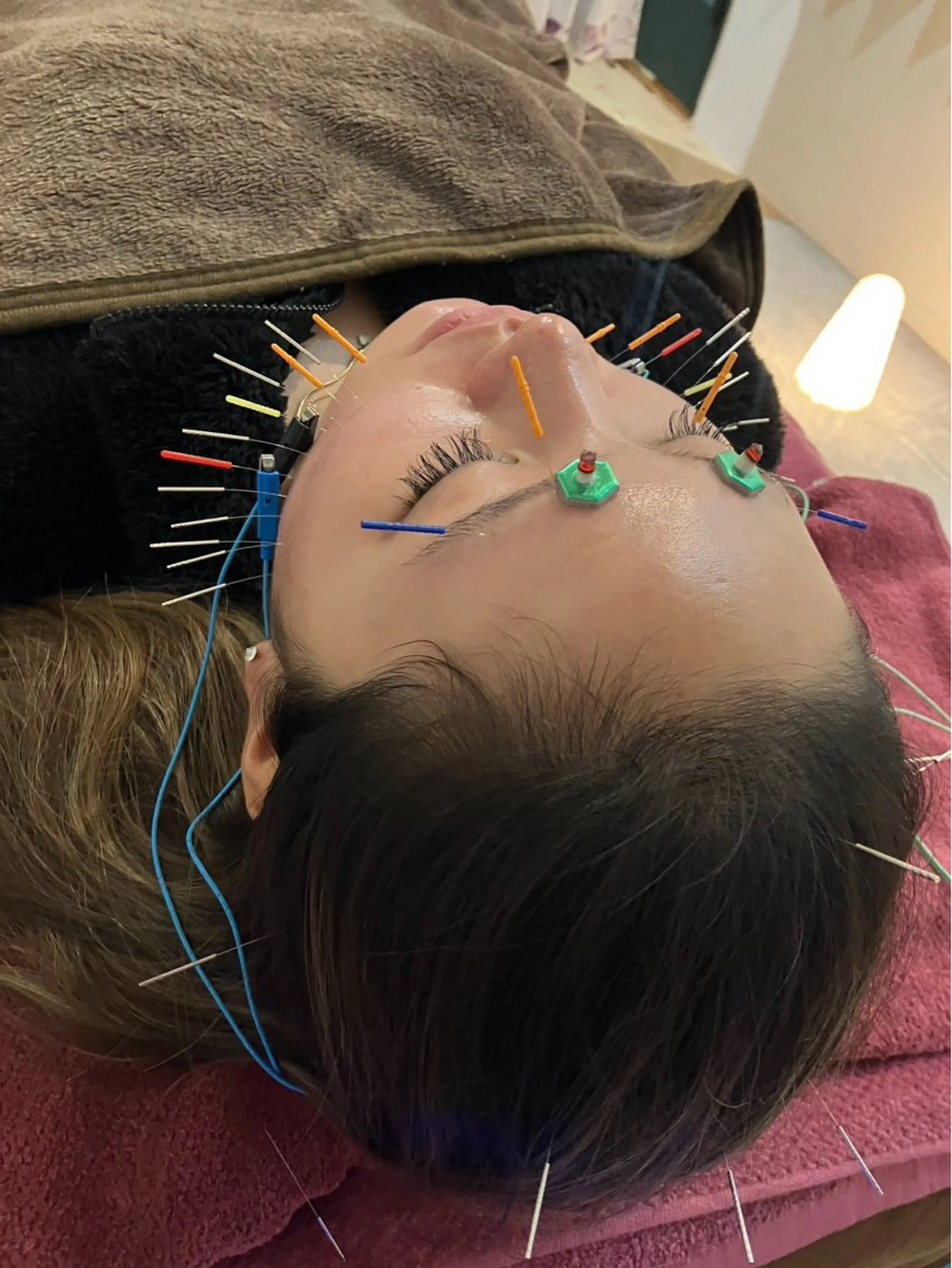 エステ リラク 美容鍼灸女性専用 りんご鍼灸治療院のその他イメージ