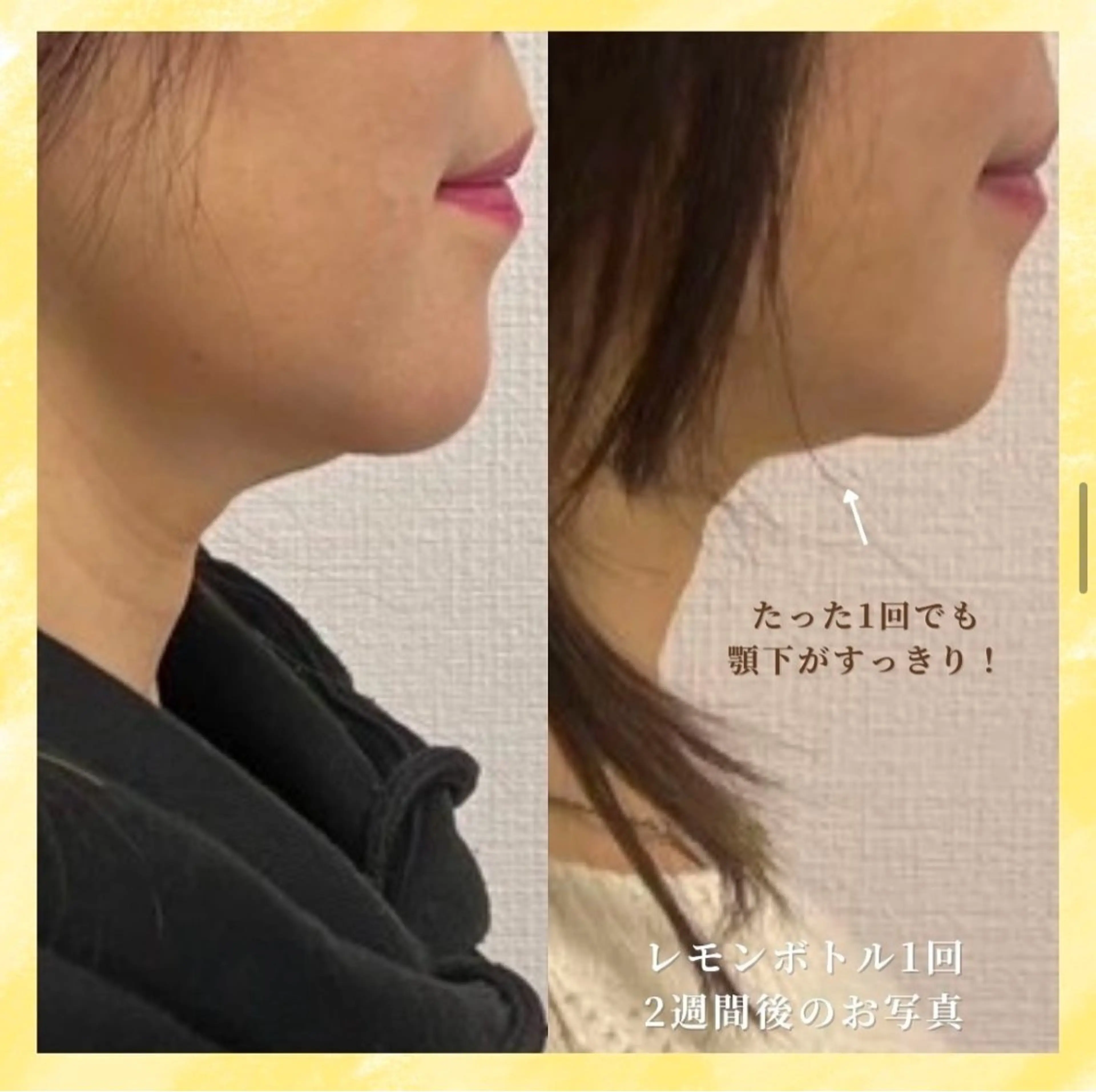 エステ 看護師が施術する小顔 サロン/KIKIのエステ・リラクイメージ