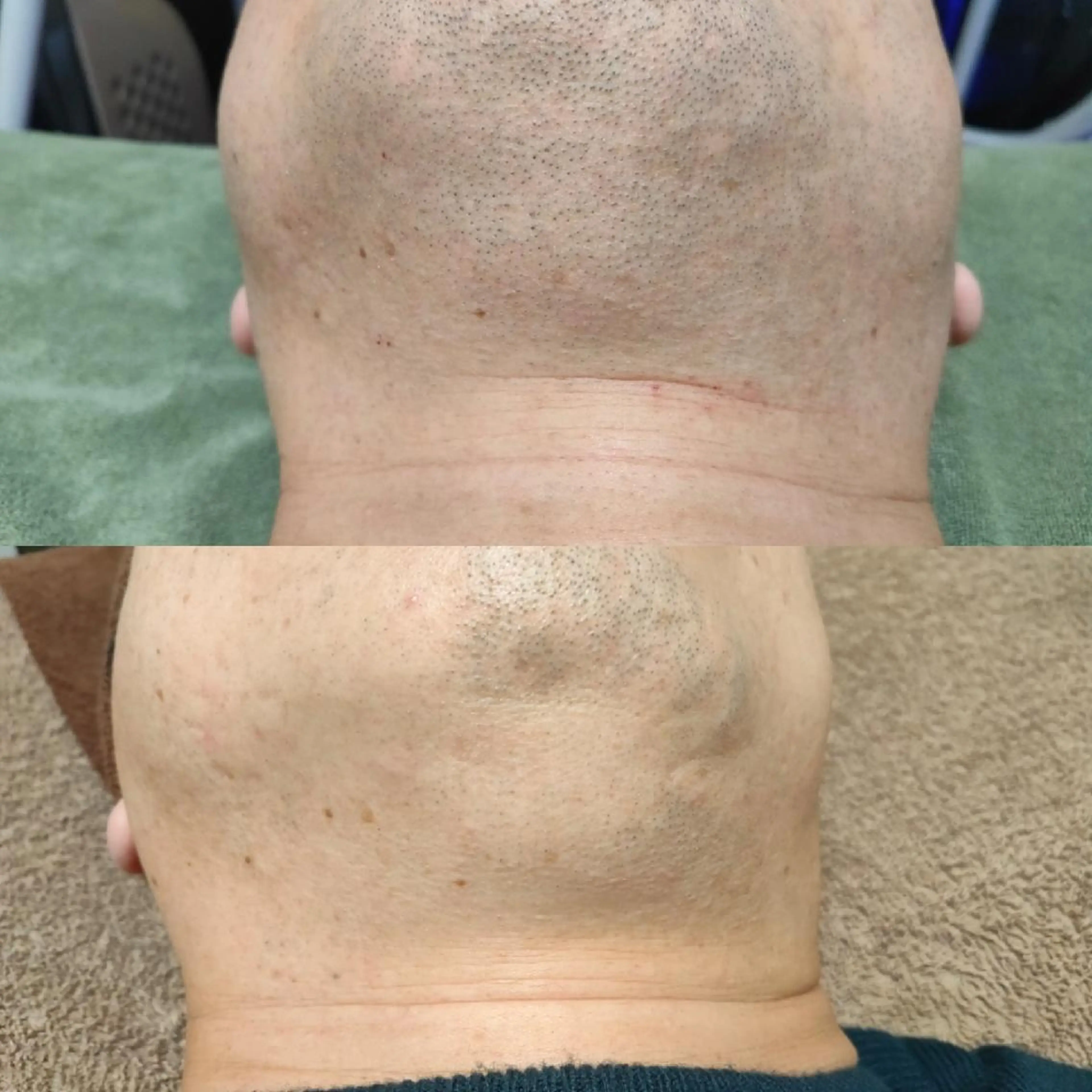 メンズ 武 藤のエステ・リラクイメージ