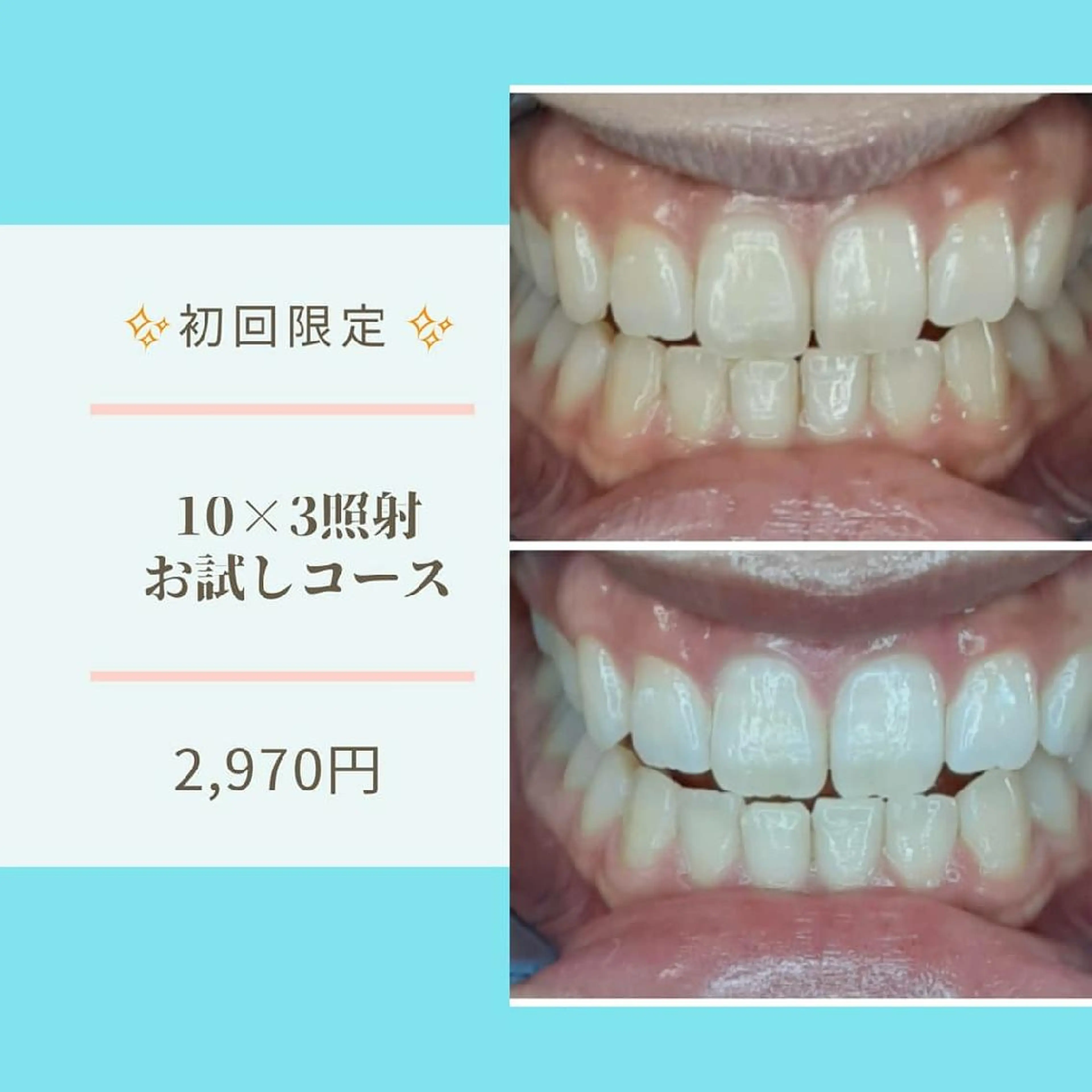 その他 五十嵐 蓮のその他イメージ