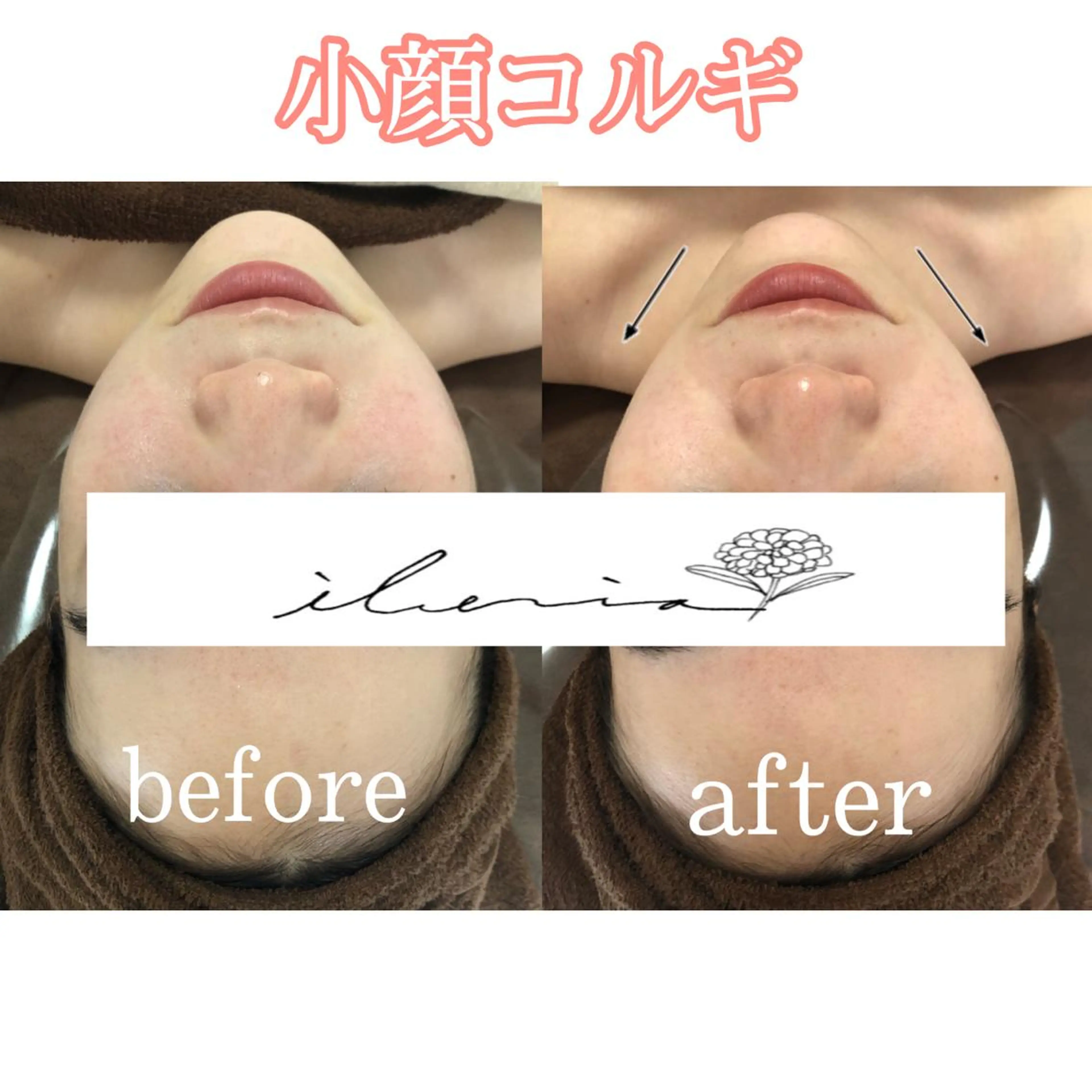 心斎橋痩身ダイエット 韓国.美容鍼.小顔のエステ・リラクイメージ