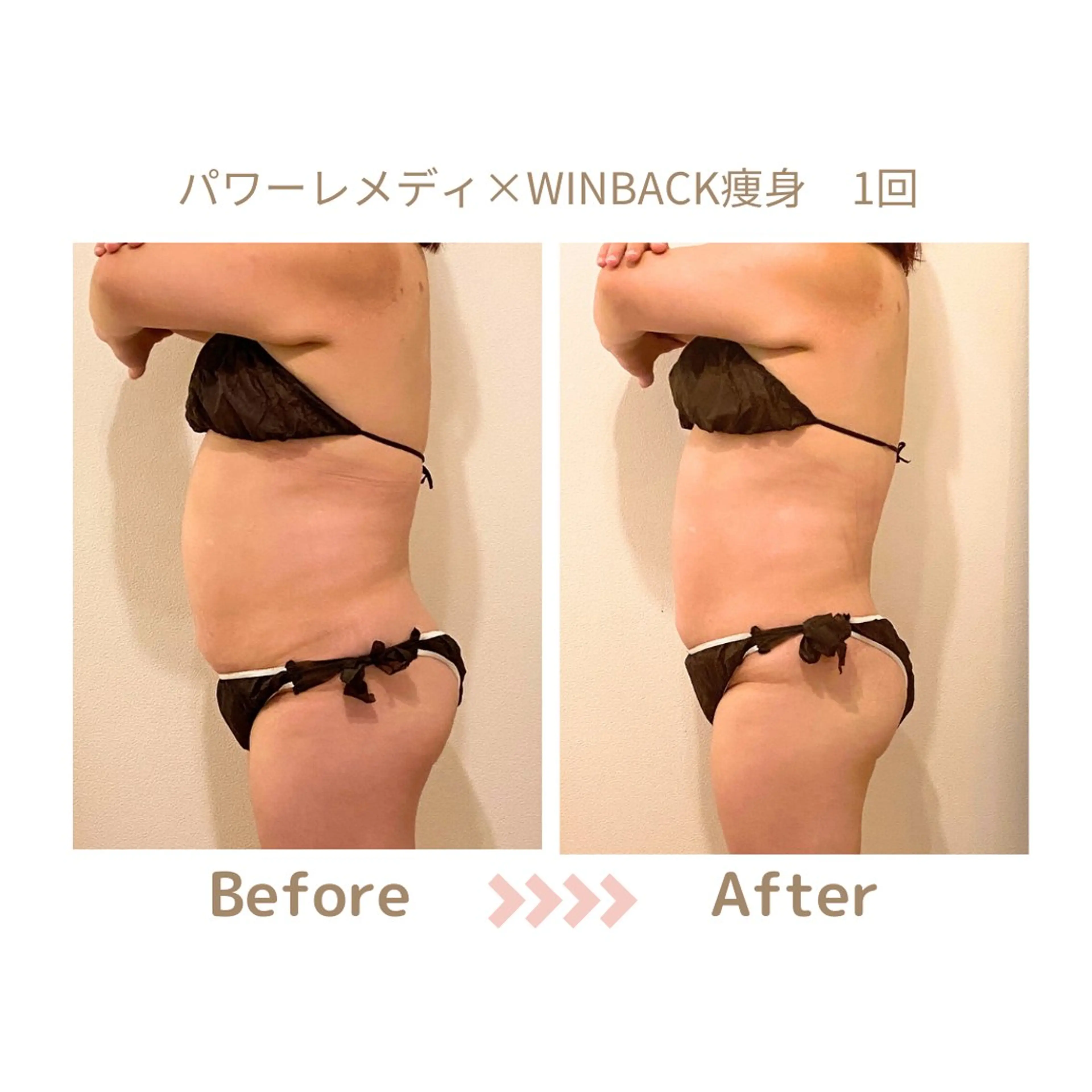 肌質改善×小顔サロン リトリト垣内のエステ・リラクイメージ