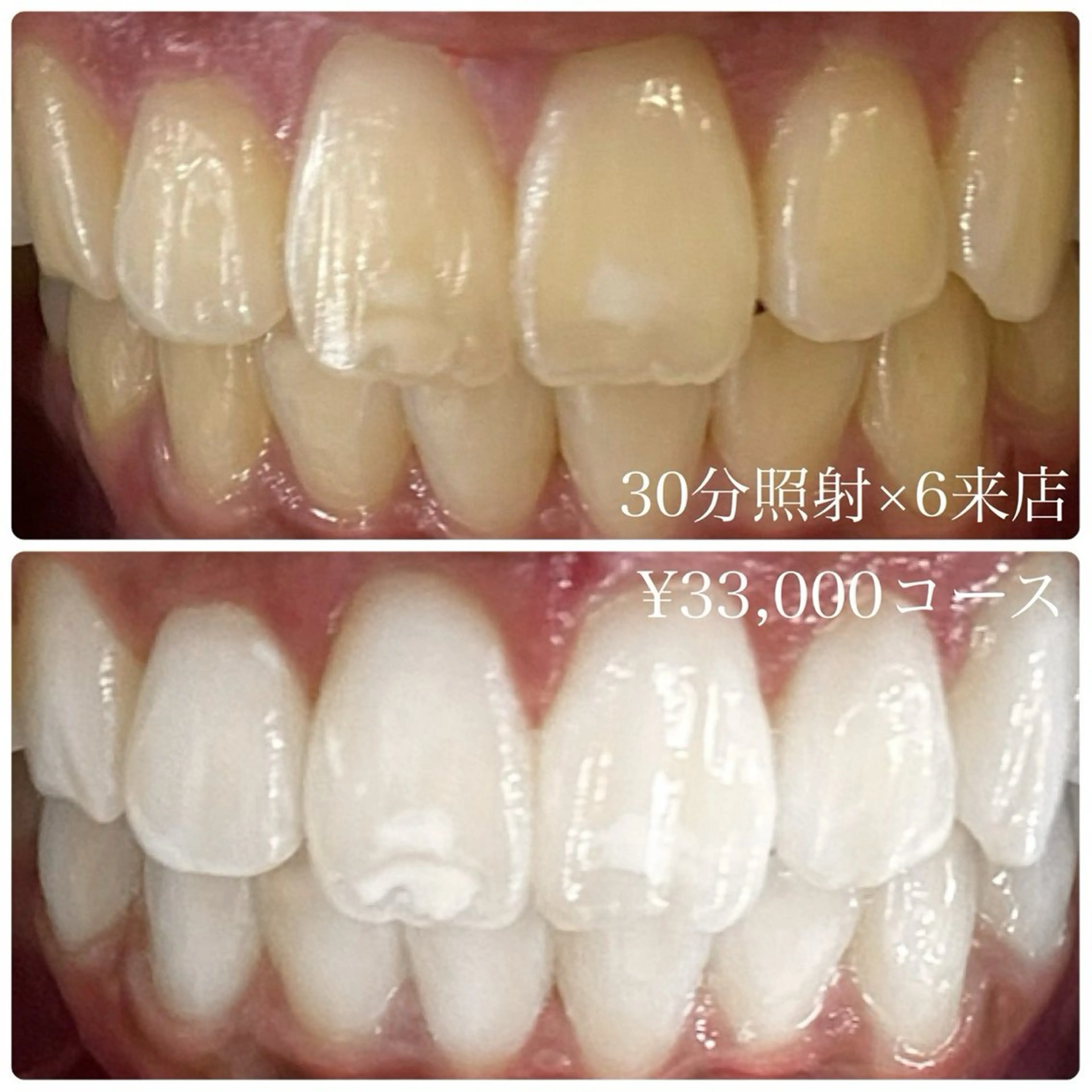 PLATINUM Beauty 横浜店所属・ホワイトニングルーム 横浜店のその他イメージ