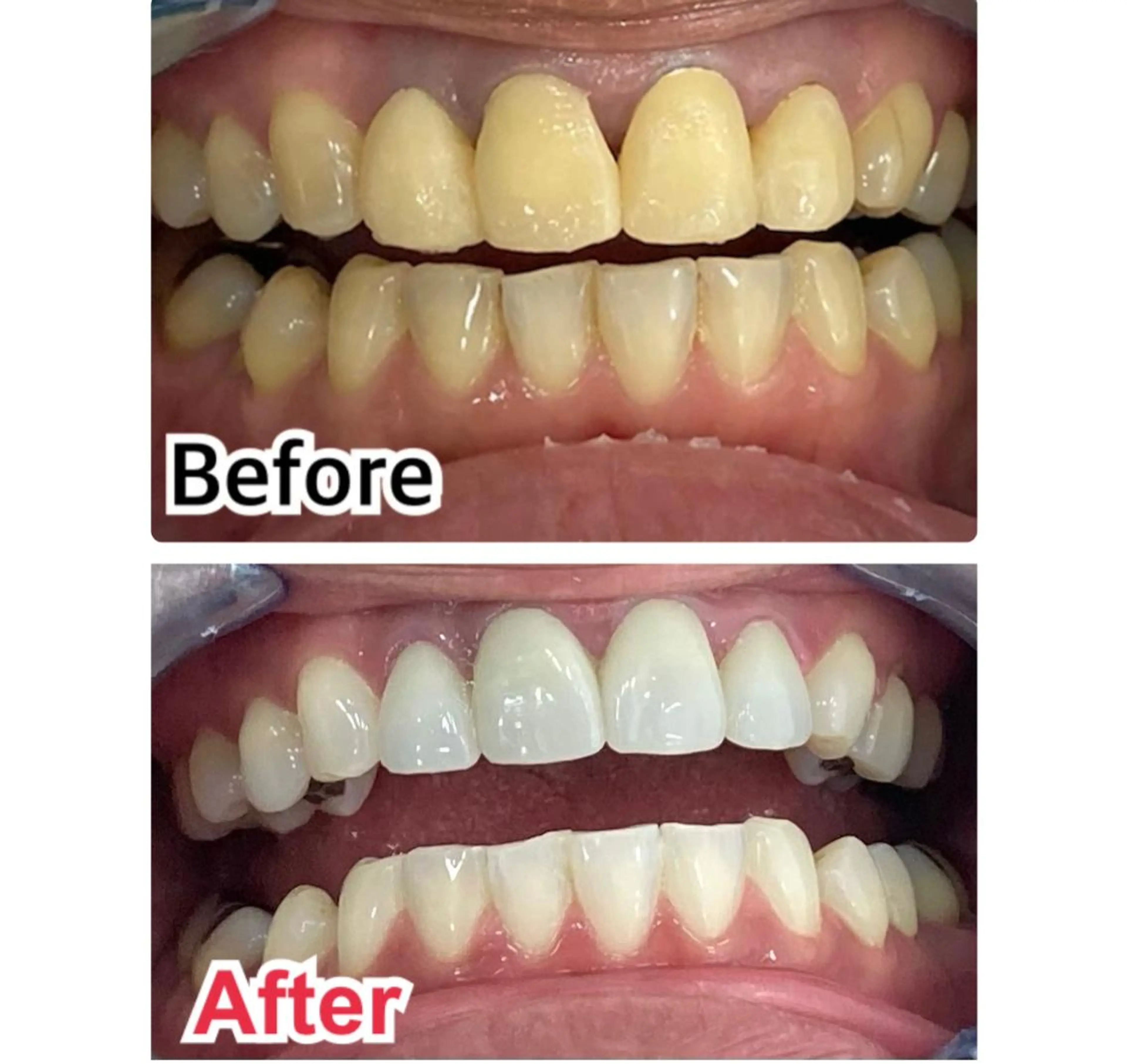 メンズ キッズ ネイル マツエク・マツパ アイブロウ 【歯科提携】柏ホワイ トニングスタイルのその他イメージ