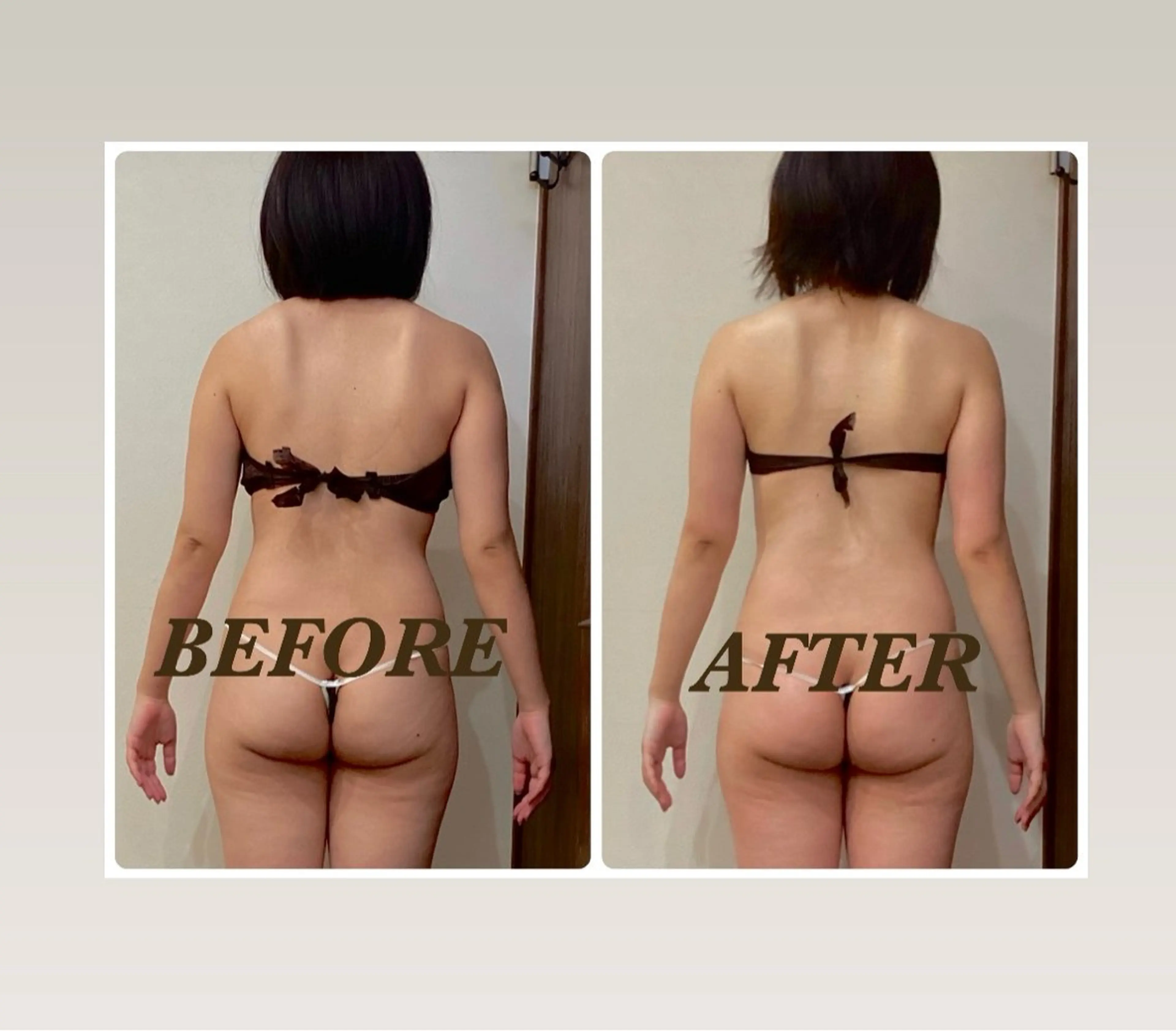 【お悩み部位集中】🤲徹底アプローチ3Dスリムハンド&各種マシン60分×2回¥7,700🔥🔥🔥の写真