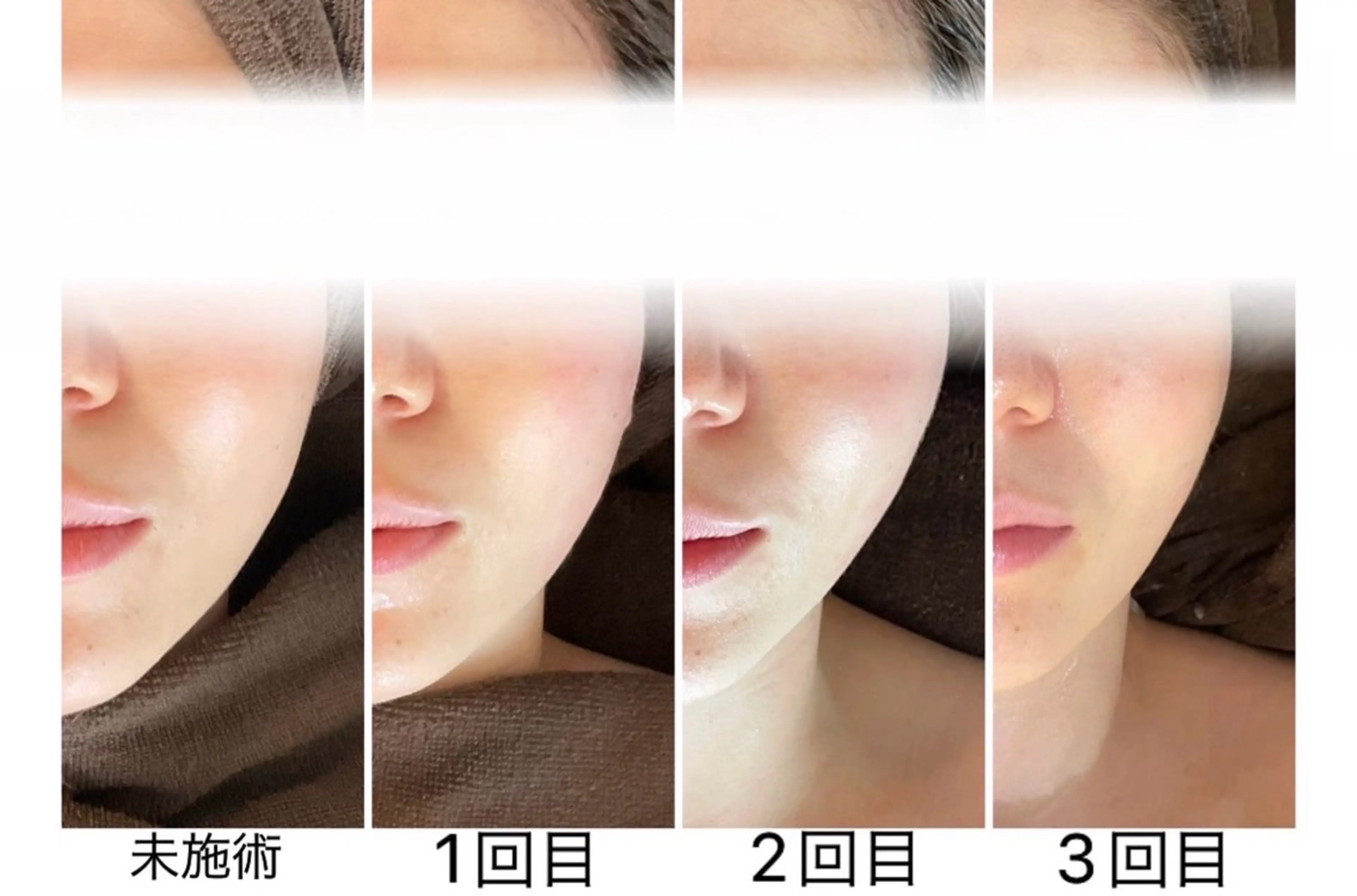 MIRAI小顔 溝の口店のエステ・リラクイメージ